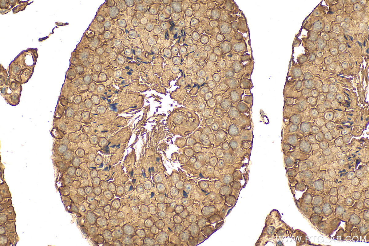 Immunohistochemistry (IHC) staining of mouse testis tissue using TPR Recombinant antibody (83177-5-RR)