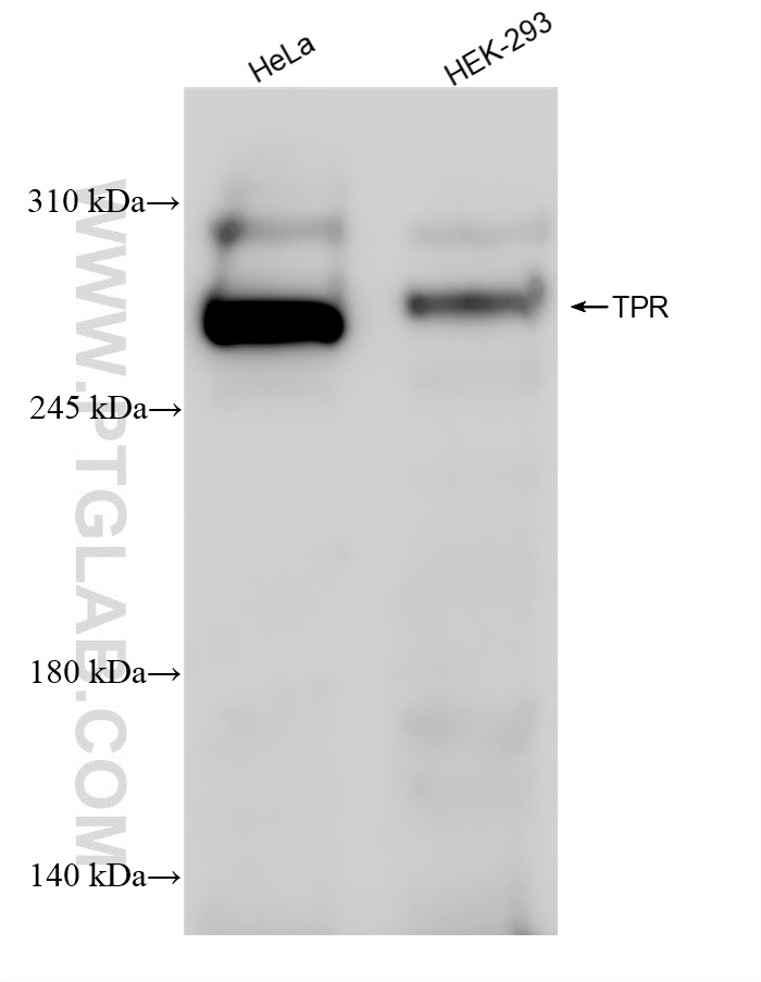 Western Blot (WB) analysis of various lysates using TPR Recombinant antibody (83177-5-RR)