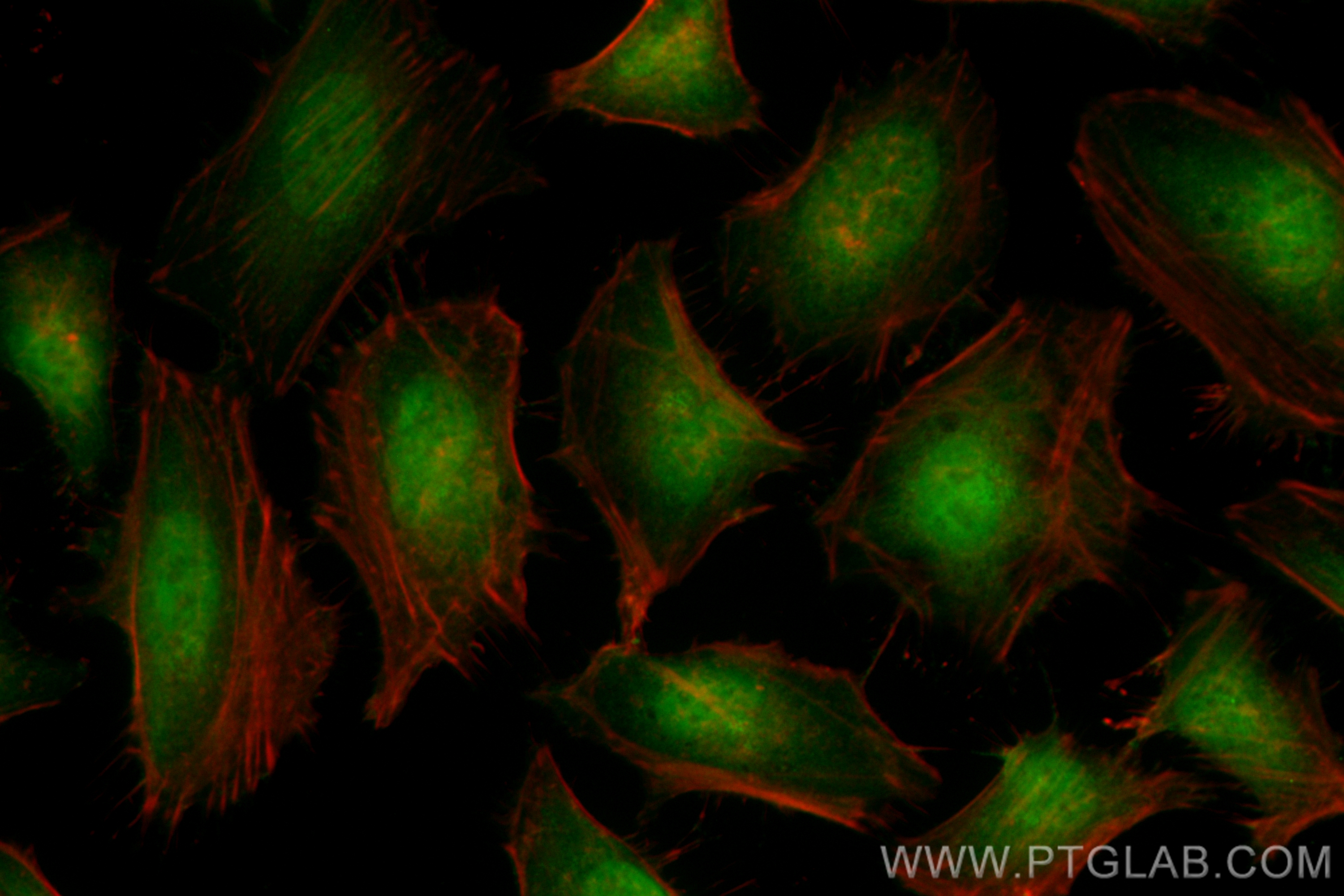 Immunofluorescence (IF) / fluorescent staining of HeLa cells using CoraLite® Plus 488-conjugated TPR Recombinant anti (CL488-83177-5)