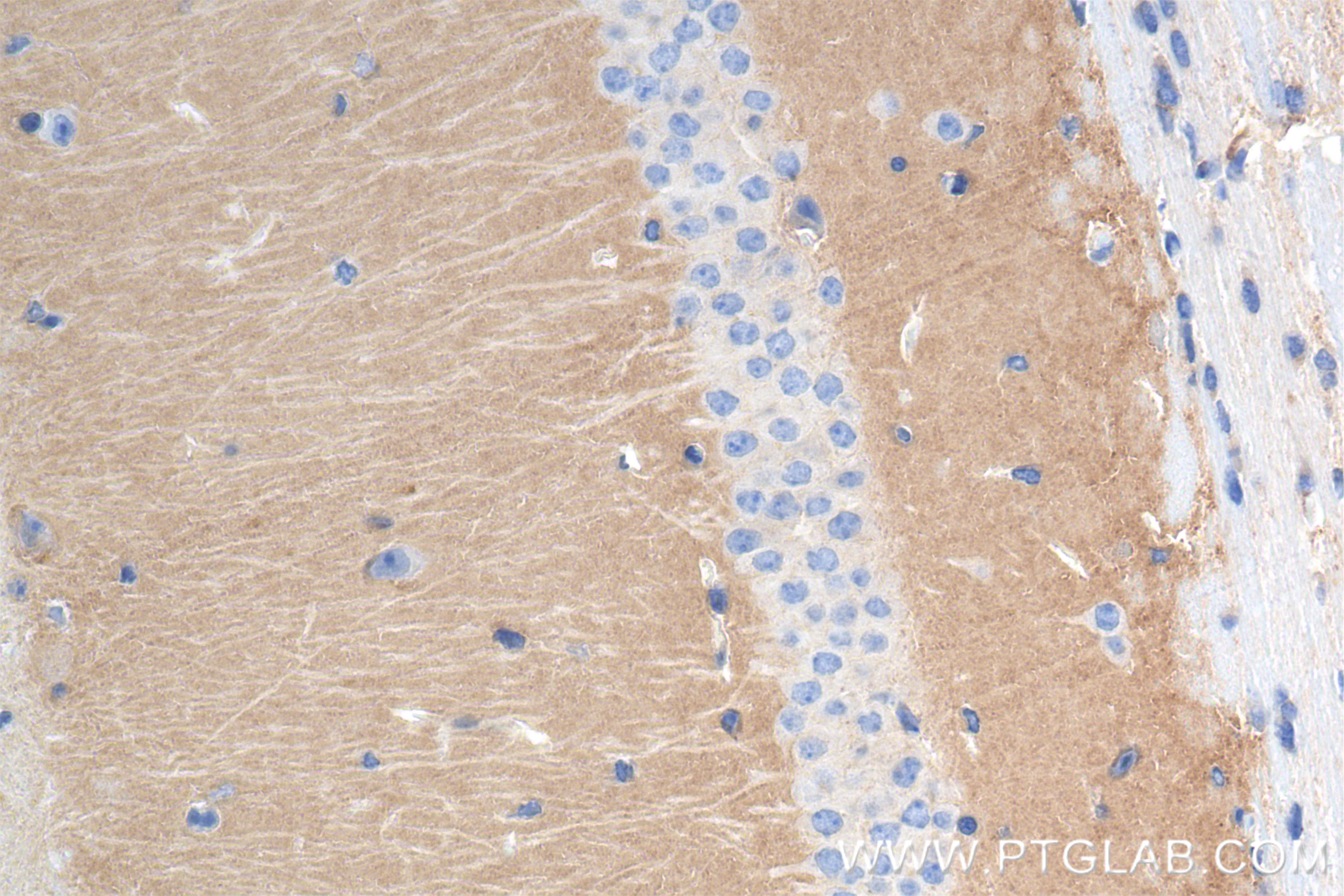 Immunohistochemistry (IHC) staining of mouse brain tissue using TPRG1L Recombinant antibody (83989-4-RR)