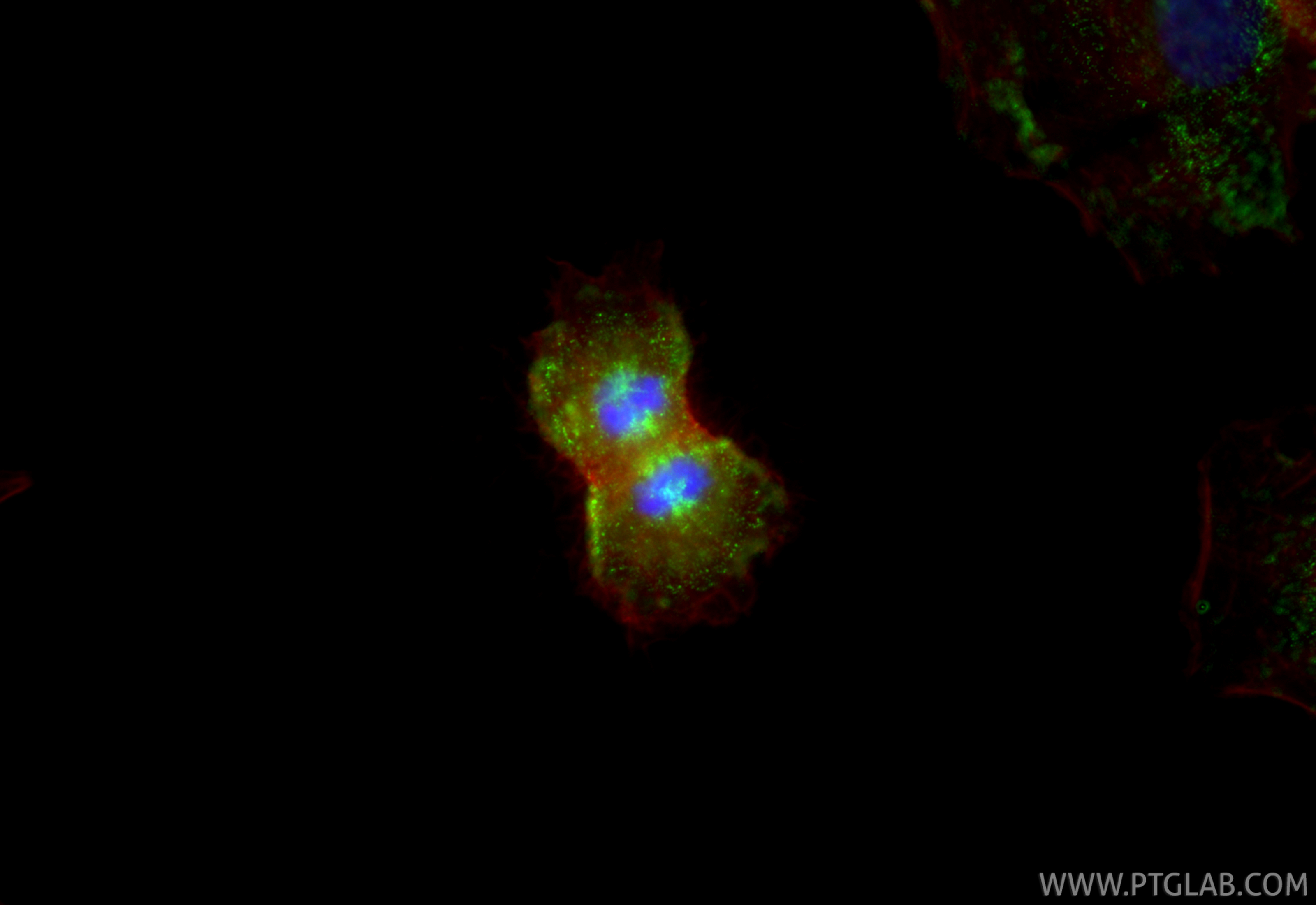 Immunofluorescence (IF) / fluorescent staining of A549 cells using TPX2 Monoclonal antibody (68712-1-Ig)