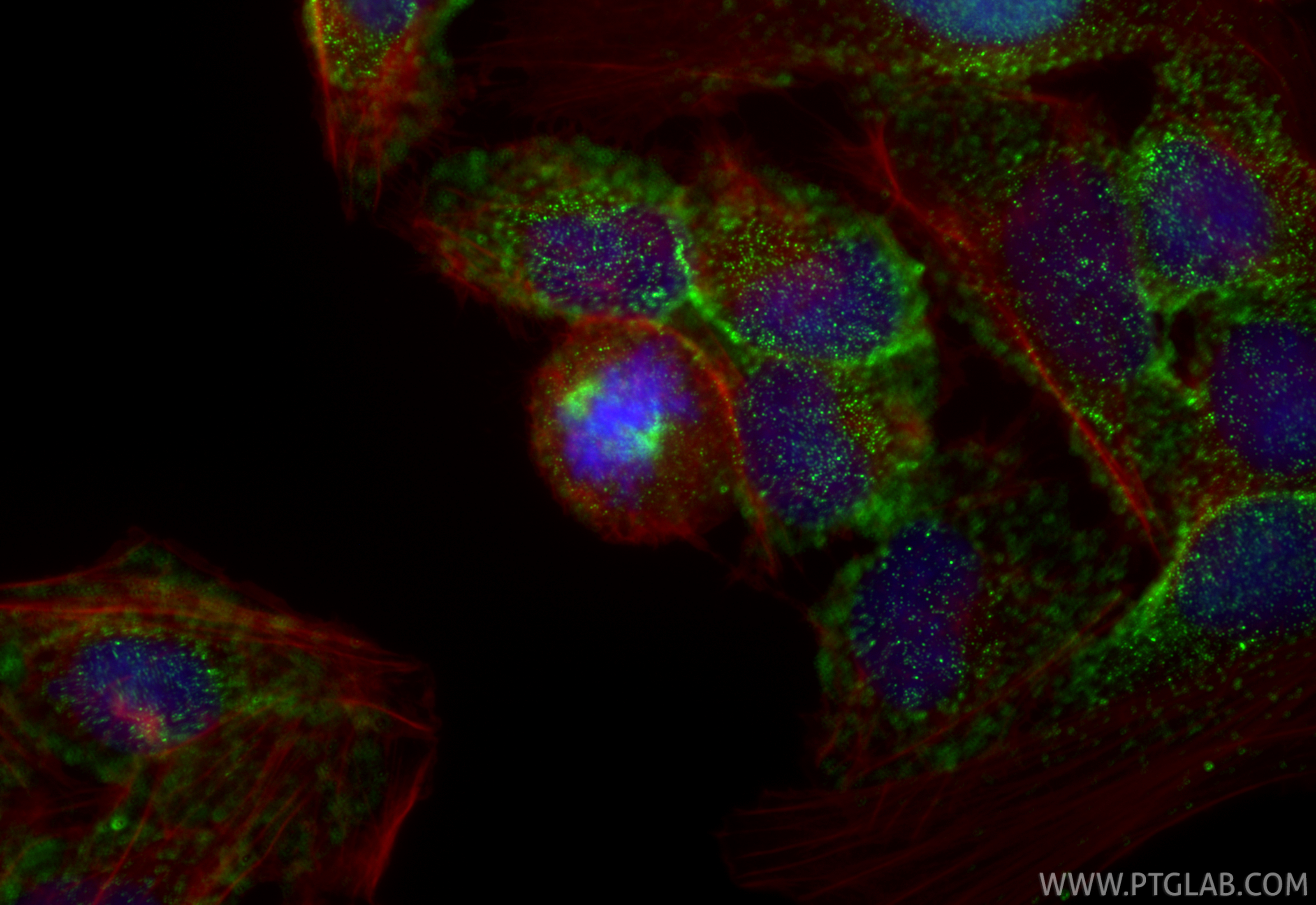 Immunofluorescence (IF) / fluorescent staining of U2OS cells using TPX2 Monoclonal antibody (68712-1-Ig)