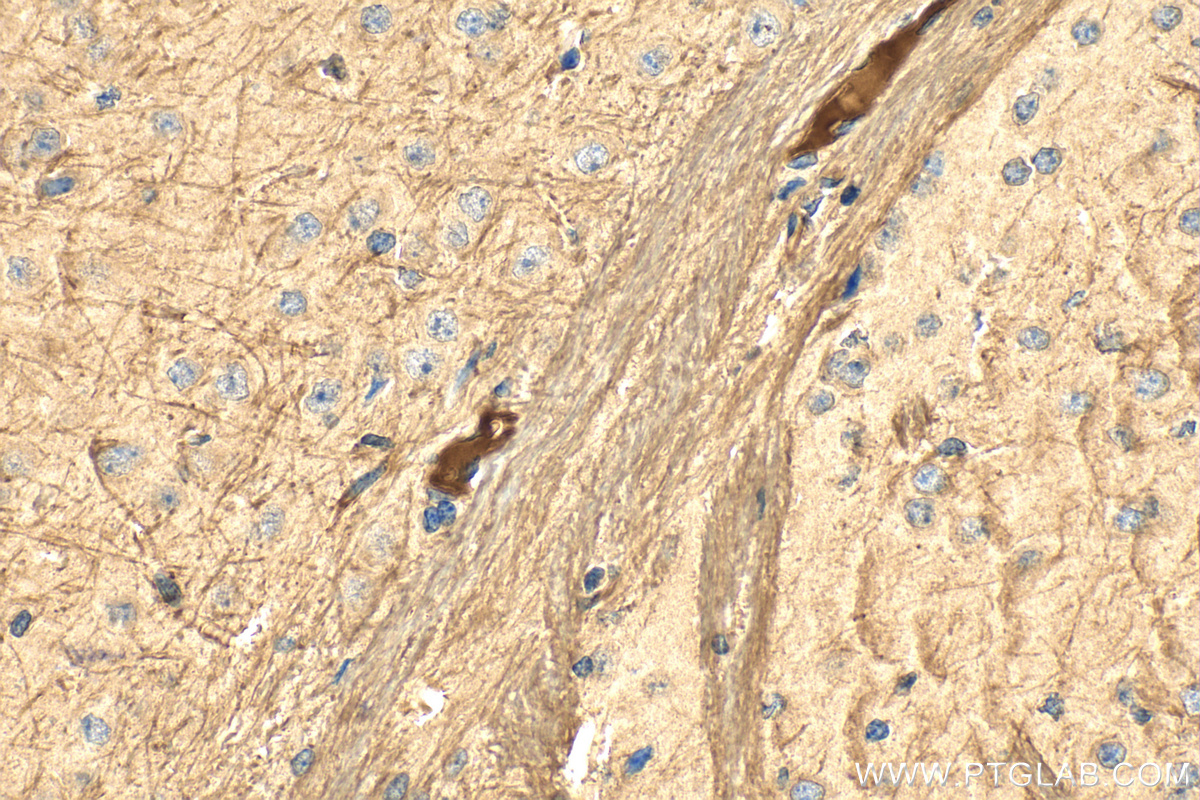 Immunohistochemistry (IHC) staining of mouse brain tissue using TRADD Polyclonal antibody (15468-1-AP)