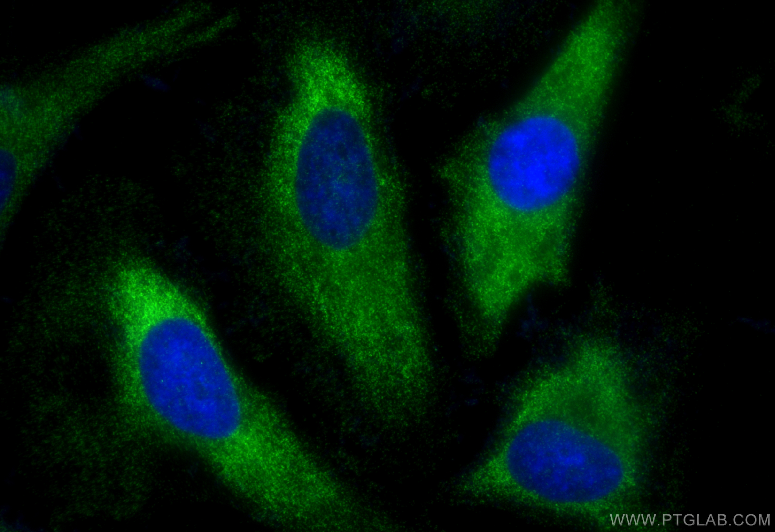 Immunofluorescence (IF) / fluorescent staining of HeLa cells using TRAF2 Polyclonal antibody (26846-1-AP)