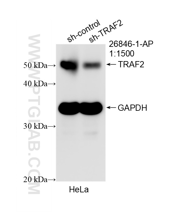 Western Blot (WB) analysis of HeLa cells using TRAF2 Polyclonal antibody (26846-1-AP)