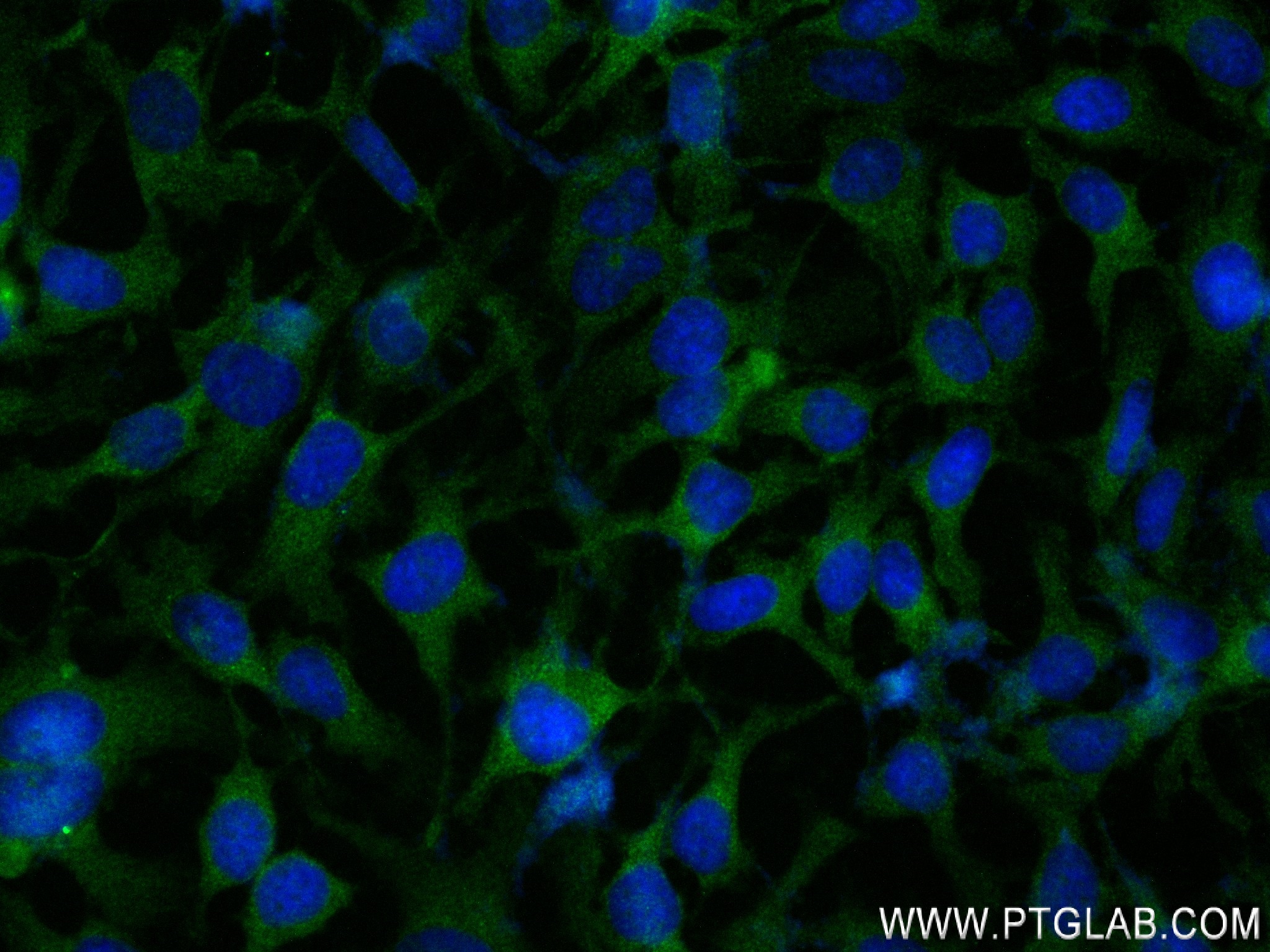 Immunofluorescence (IF) / fluorescent staining of HeLa cells using TRAF2 Recombinant antibody (84581-3-RR)