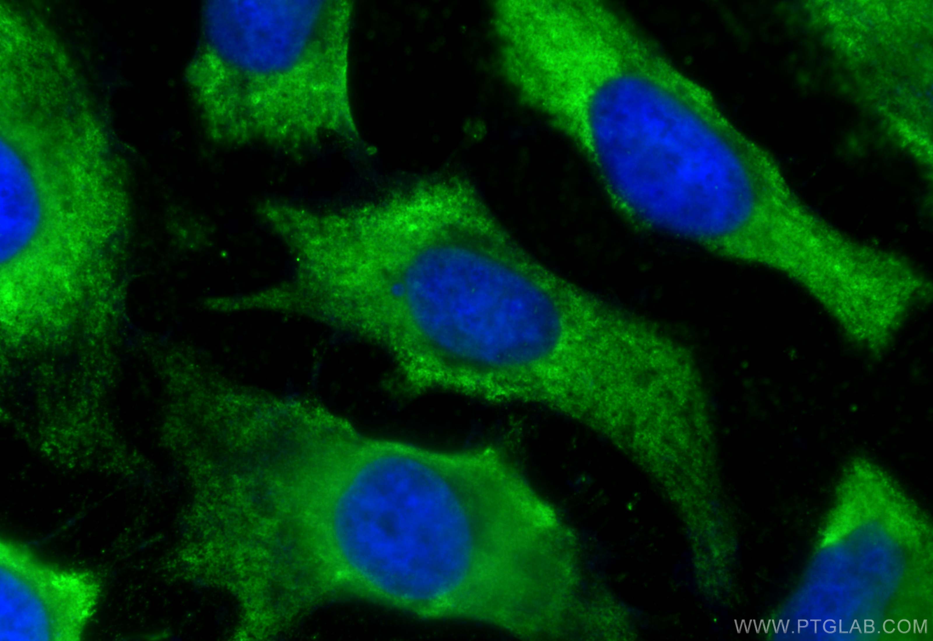 Immunofluorescence (IF) / fluorescent staining of HeLa cells using CoraLite® Plus 488-conjugated TRAF2 Monoclonal ant (CL488-67315)