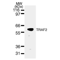 TRAF2 mAb tested by Western blot. TRAF2 detection by Western blot. The analysis was performed using 30 ug HeLa nuclear extract and TRAF2 mAb at a 2 ug/ml dilution.