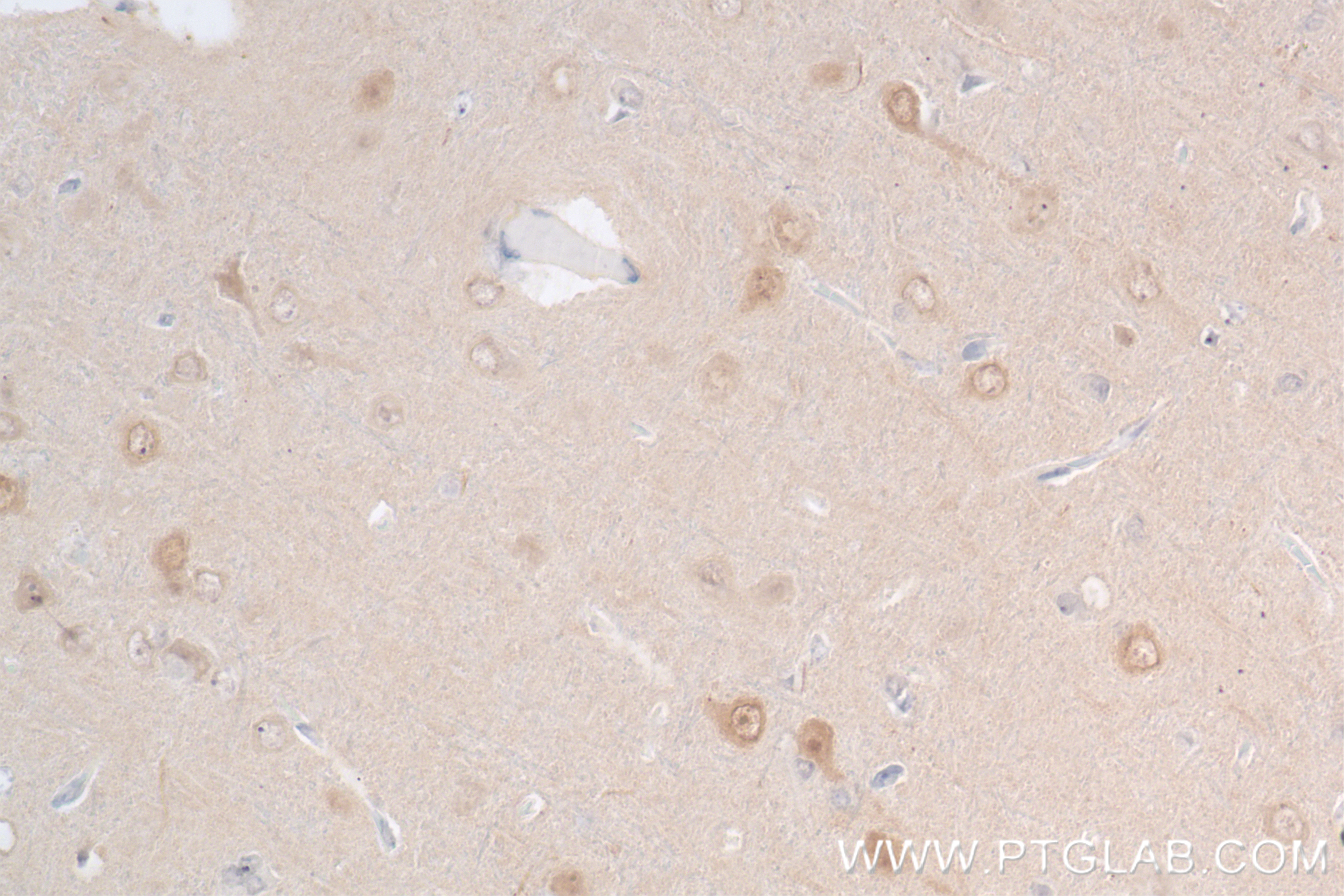 Immunohistochemistry (IHC) staining of rat brain tissue using TRAF6 Recombinant antibody (83535-2-RR)
