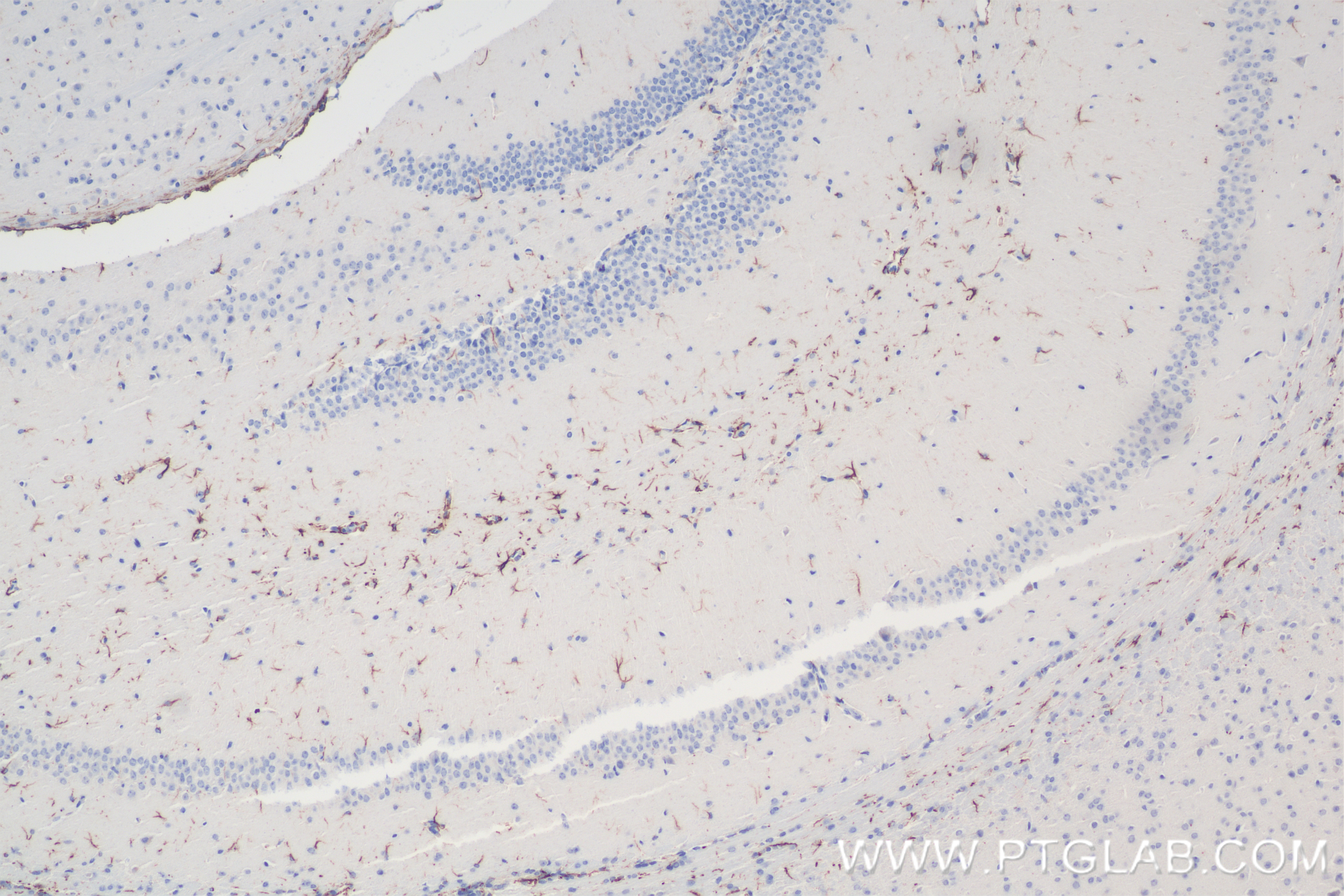 Immunohistochemistry (IHC) staining of mouse brain tissue using TRAF6 Recombinant antibody (83535-2-RR)