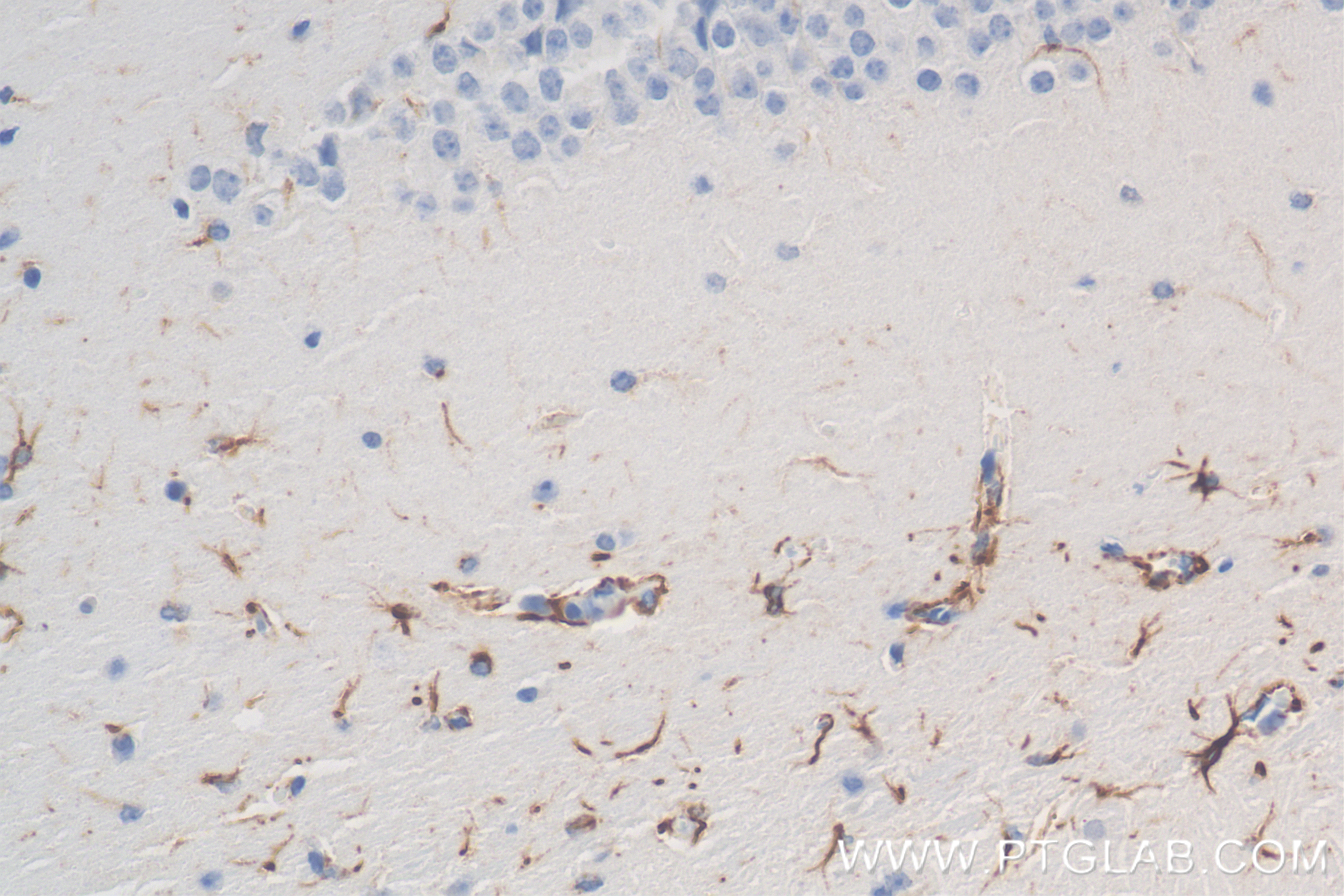 Immunohistochemistry (IHC) staining of mouse brain tissue using TRAF6 Recombinant antibody (83535-2-RR)