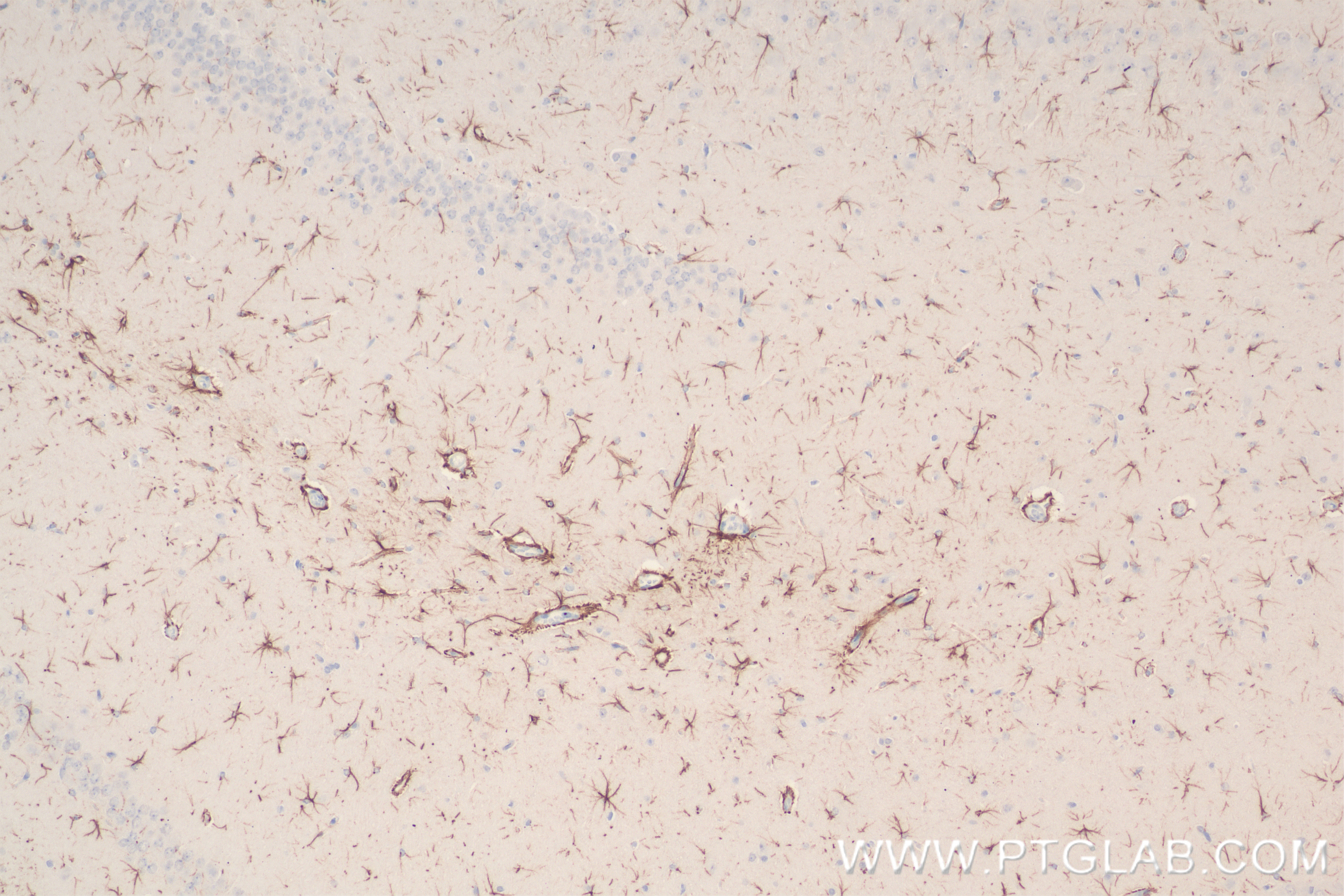Immunohistochemistry (IHC) staining of rat brain tissue using TRAF6 Recombinant antibody (83535-2-RR)