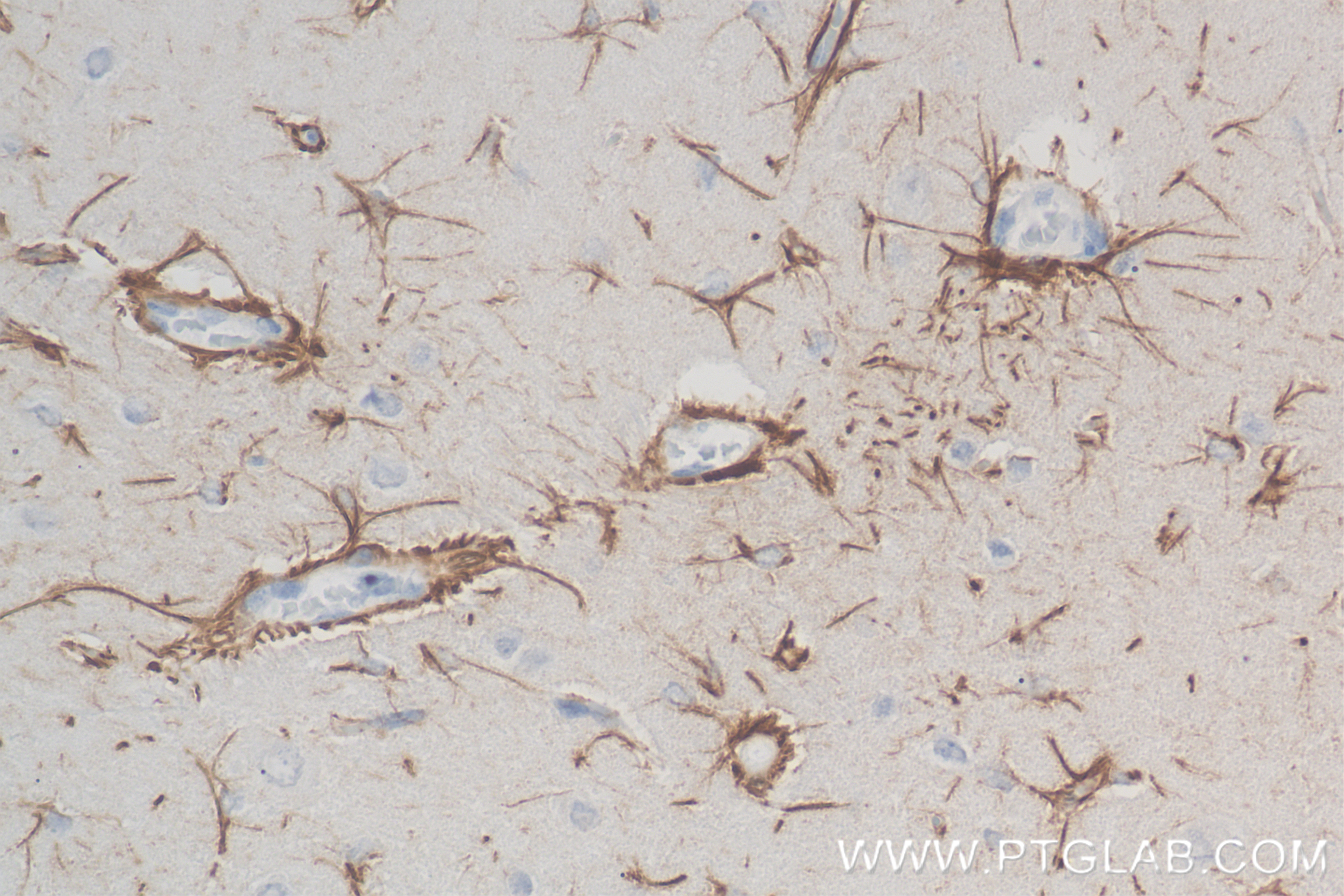 Immunohistochemistry (IHC) staining of rat brain tissue using TRAF6 Recombinant antibody (83535-2-RR)