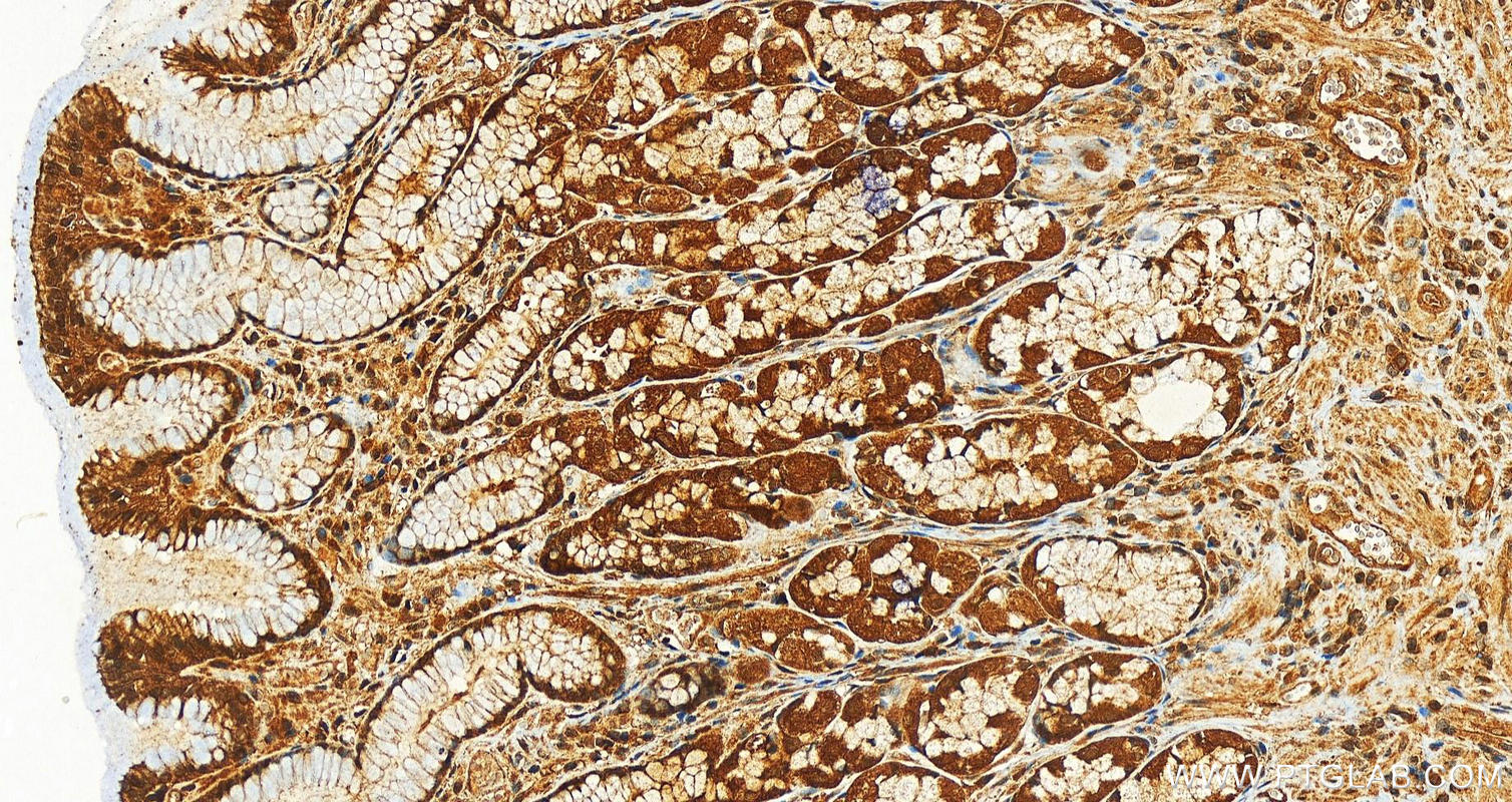 Immunohistochemistry (IHC) staining of human stomach tissue using TRAPPC2 Polyclonal antibody (12484-1-AP)