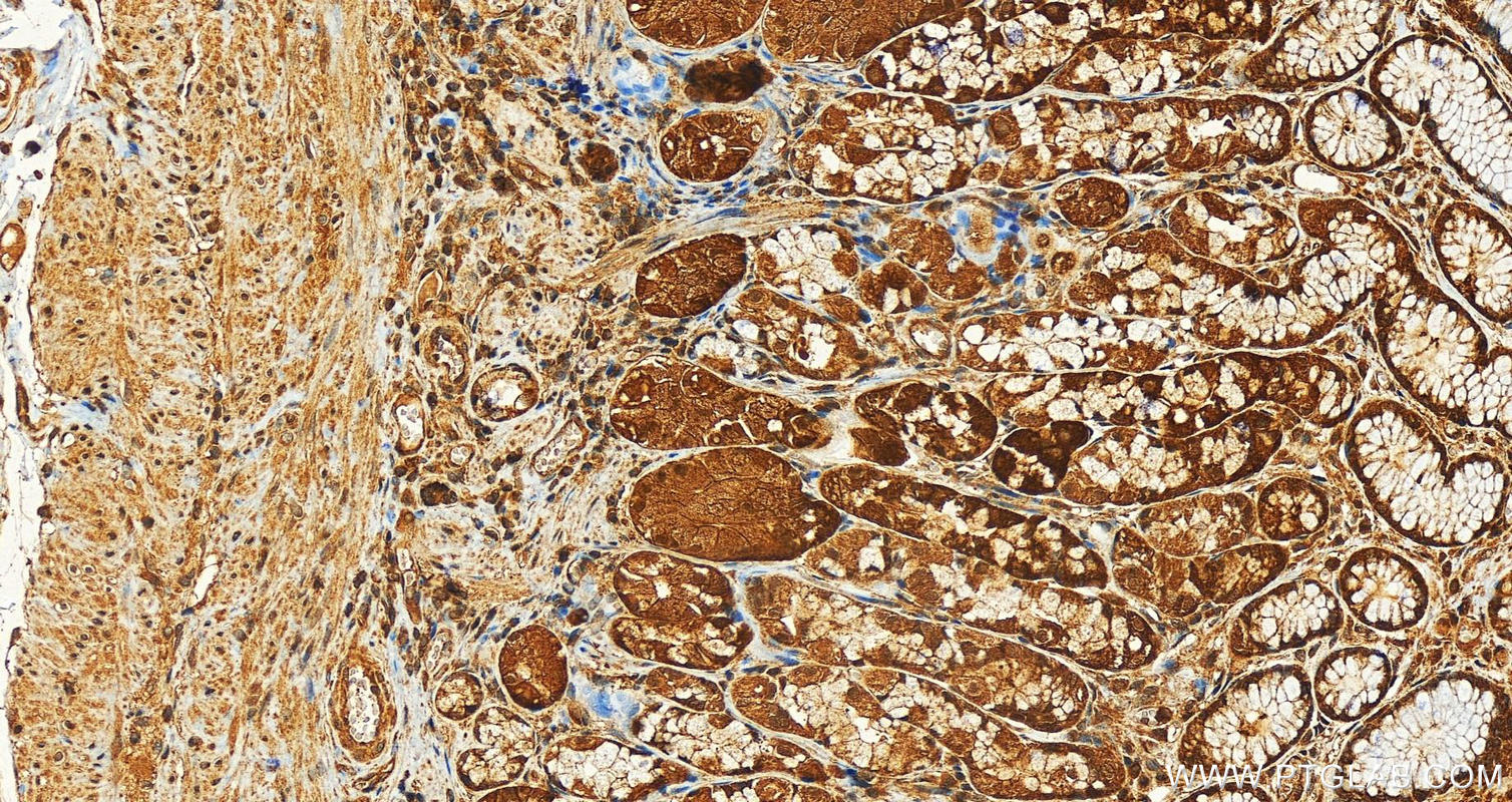 Immunohistochemistry (IHC) staining of human stomach tissue using TRAPPC2 Polyclonal antibody (12484-1-AP)