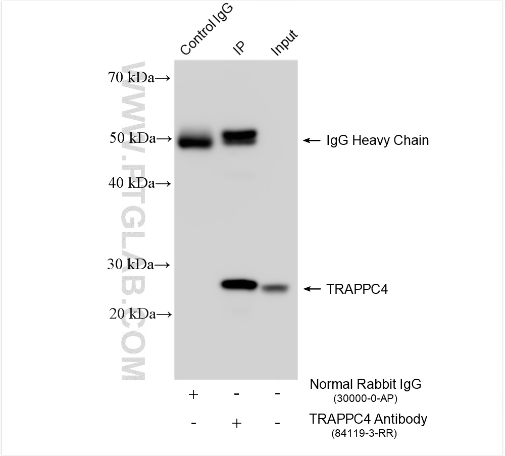 Immunoprecipitation (IP) experiment of HL-60 cells using TRAPPC4 Recombinant antibody (84119-3-RR)