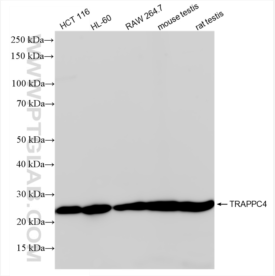 Western Blot (WB) analysis of various lysates using TRAPPC4 Recombinant antibody (84119-3-RR)