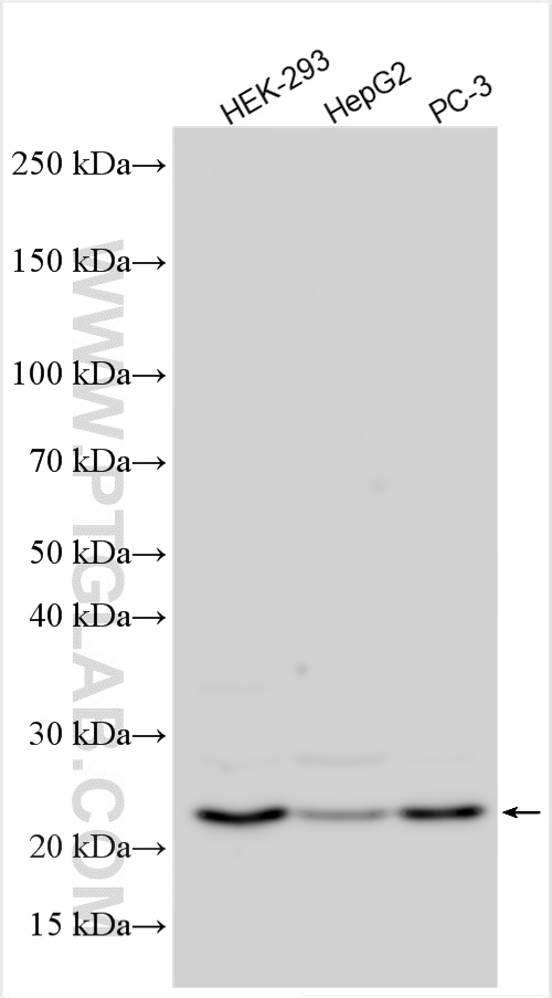 Western Blot (WB) analysis of various lysates using TRAPPC5 Polyclonal antibody (20752-1-AP)