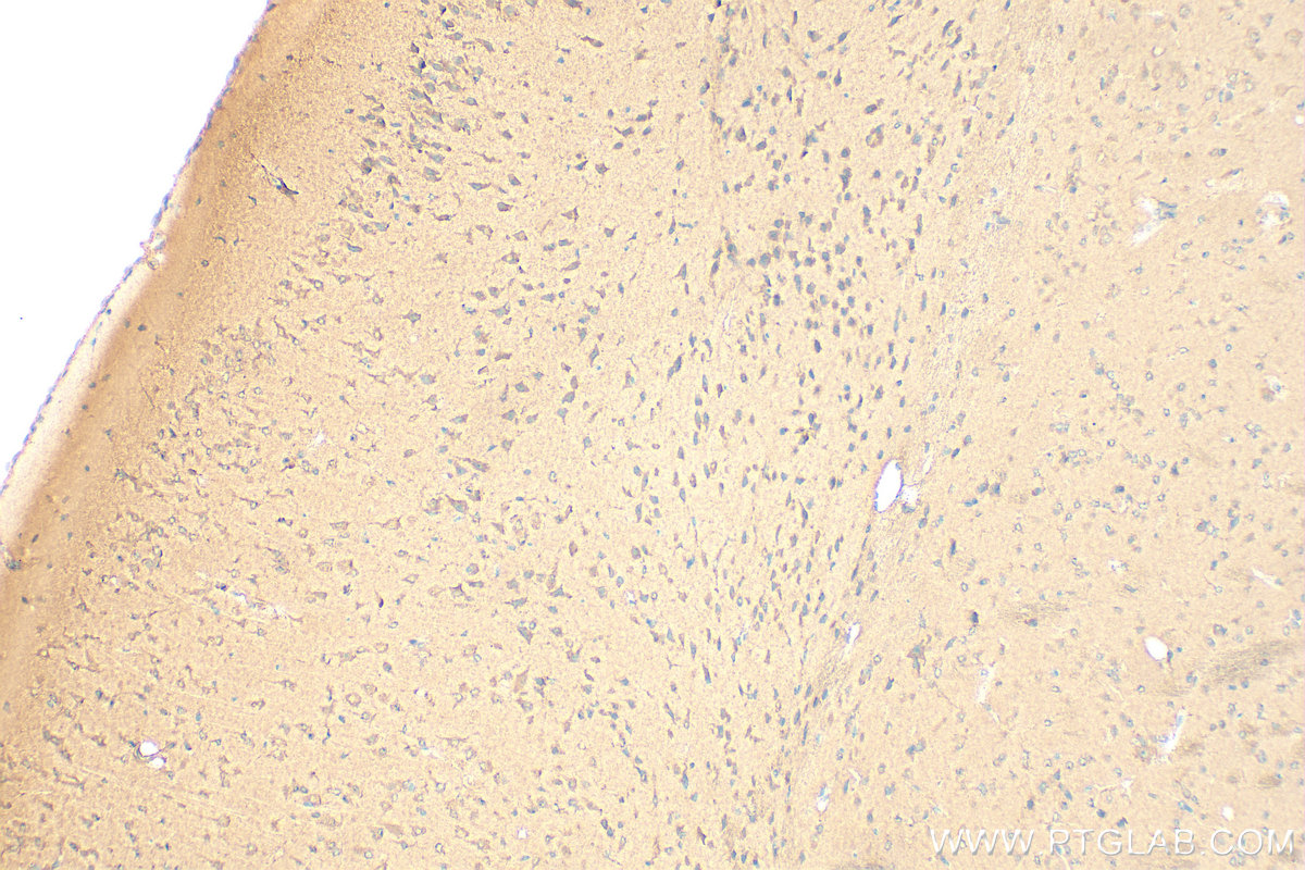 Immunohistochemistry (IHC) staining of mouse brain tissue using TRAPPC9, NIBP Polyclonal antibody (16014-1-AP)