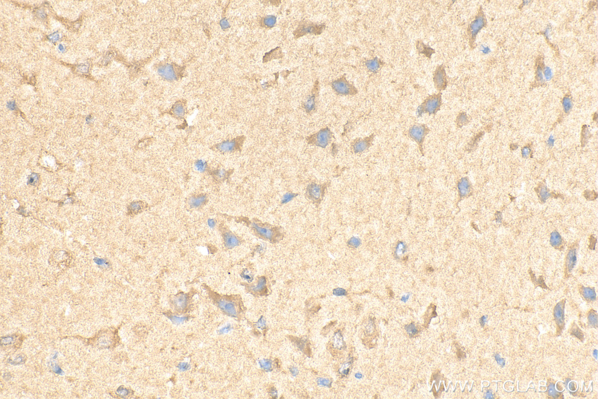 Immunohistochemistry (IHC) staining of mouse brain tissue using TRAPPC9, NIBP Polyclonal antibody (16014-1-AP)