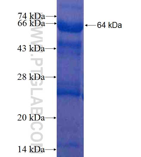 TRAPPC9,NIBP fusion protein Ag8791 SDS-PAGE