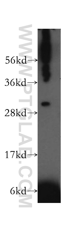 Western Blot (WB) analysis of K-562 cells using TRAV20 Polyclonal antibody (13132-1-AP)