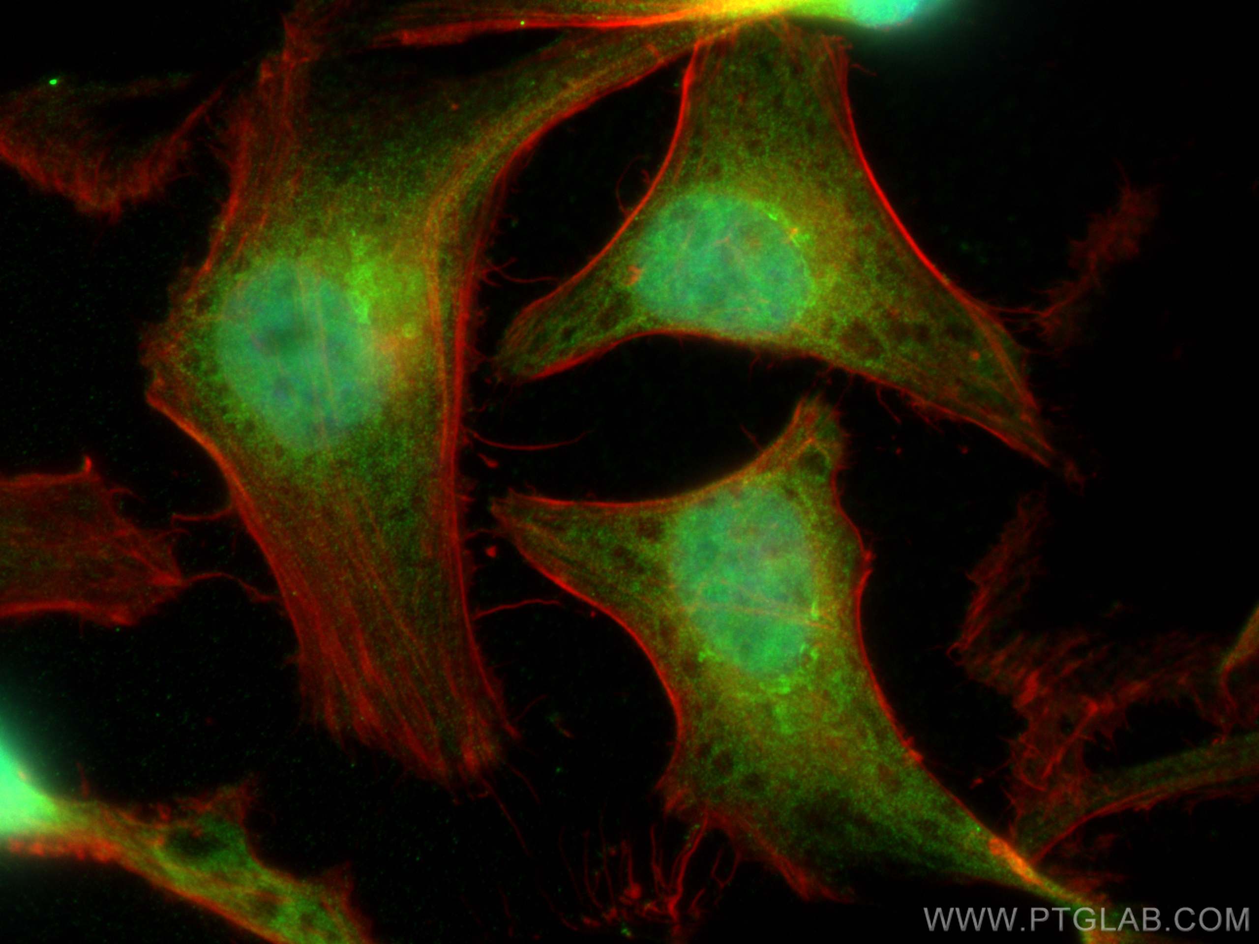 Immunofluorescence (IF) / fluorescent staining of HeLa cells using TRBP Polyclonal antibody (15753-1-AP)