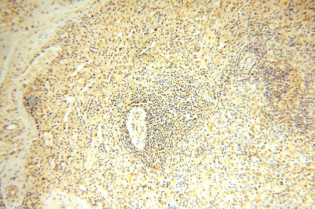 Immunohistochemistry (IHC) staining of human spleen tissue using TRBP Polyclonal antibody (15753-1-AP)