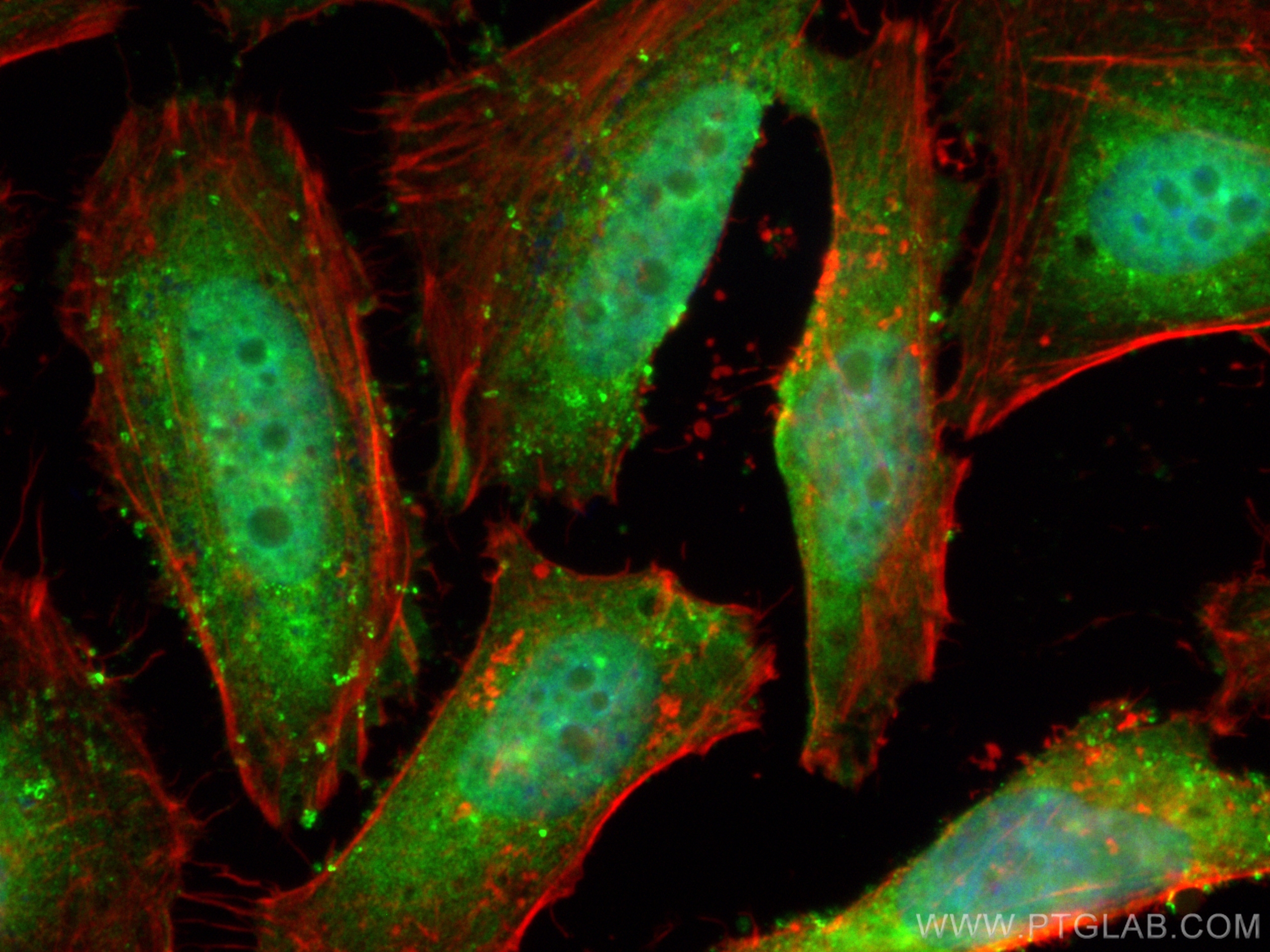 Immunofluorescence (IF) / fluorescent staining of HeLa cells using CoraLite® Plus 488-conjugated TRBP Polyclonal anti (CL488-15753)