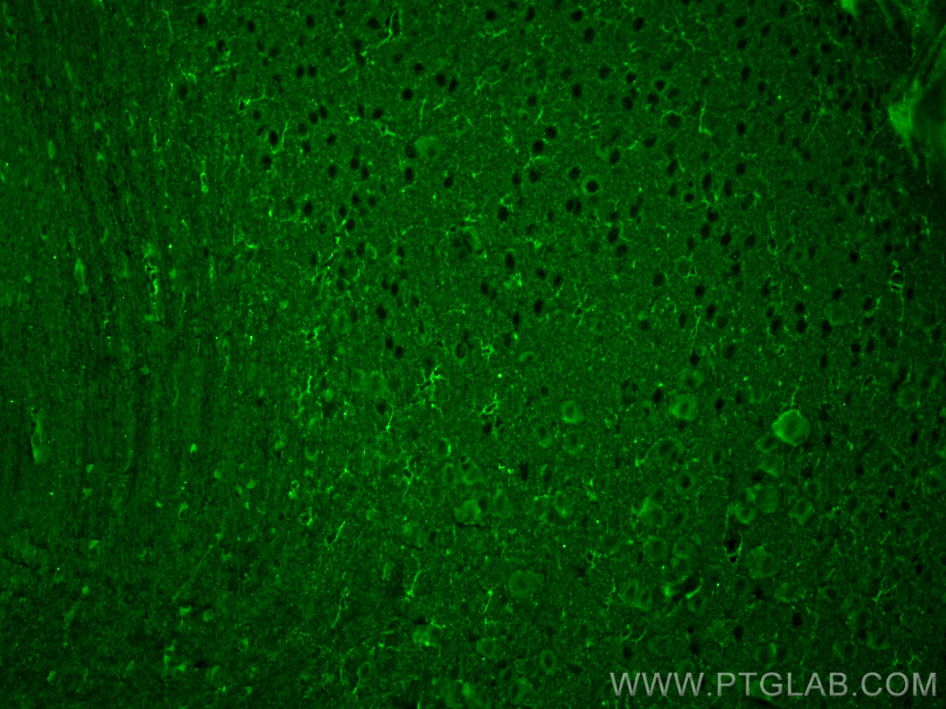 Immunofluorescence (IF) / fluorescent staining of mouse brain tissue using TREM2 Monoclonal antibody (68723-1-Ig)