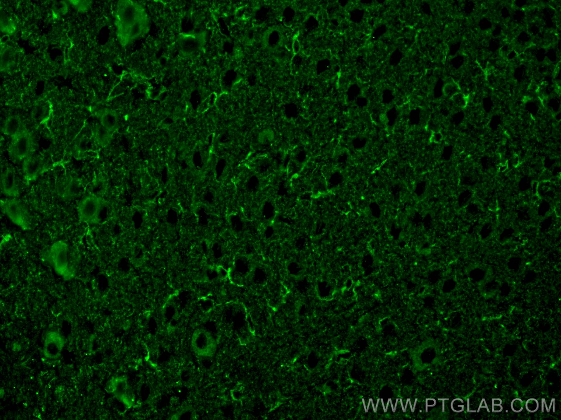 Immunofluorescence (IF) / fluorescent staining of mouse brain tissue using TREM2 Monoclonal antibody (68723-1-Ig)