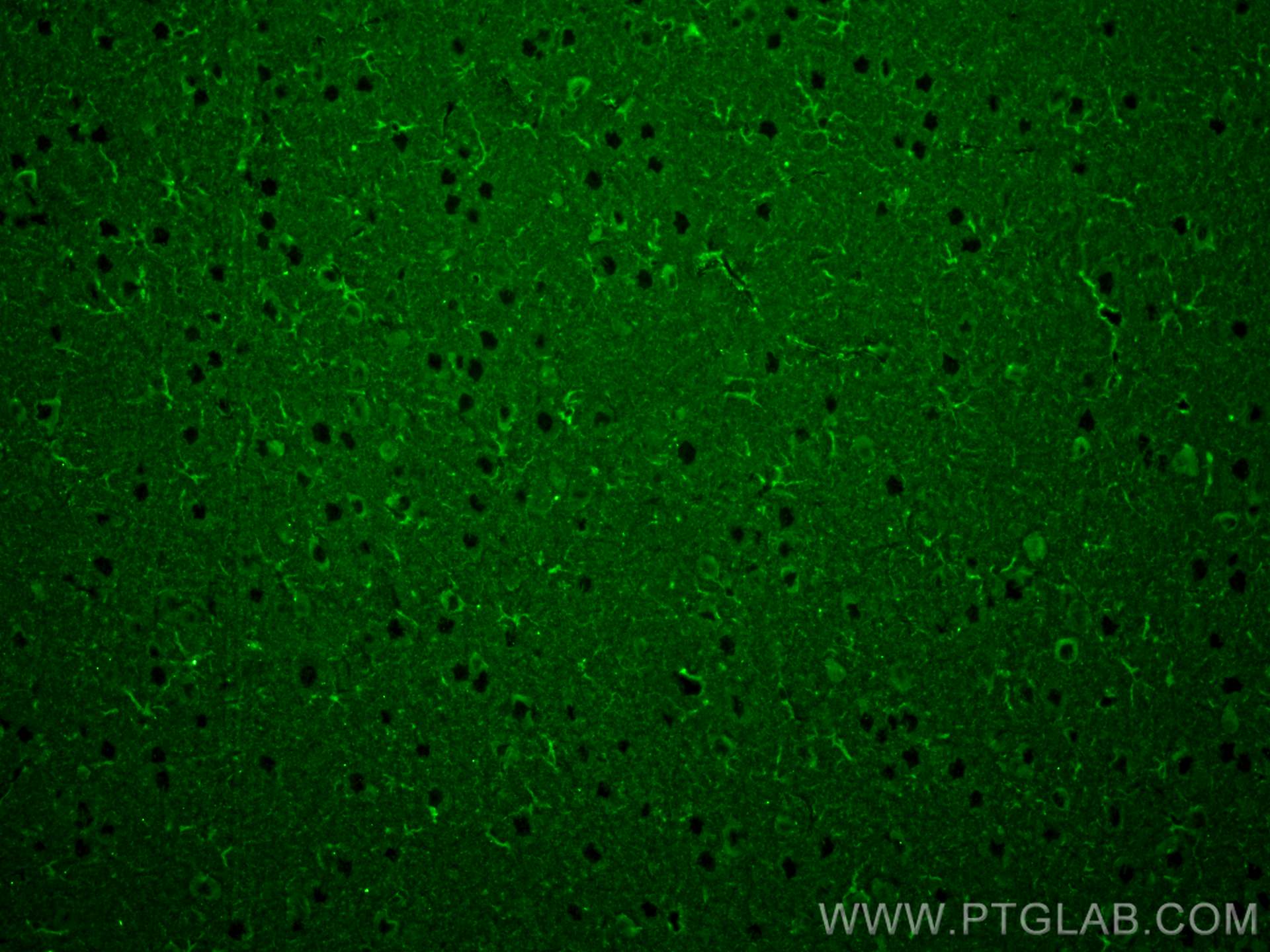 Immunofluorescence (IF) / fluorescent staining of rat brain tissue using TREM2 Monoclonal antibody (68723-1-Ig)