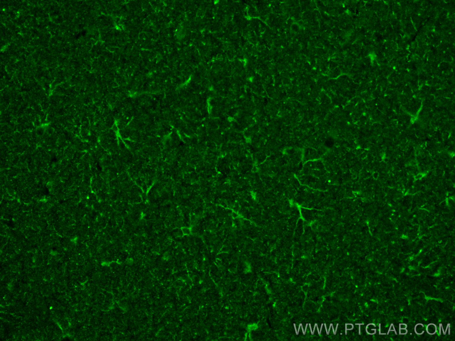 Immunofluorescence (IF) / fluorescent staining of rat brain tissue using TREM2 Monoclonal antibody (68723-1-Ig)