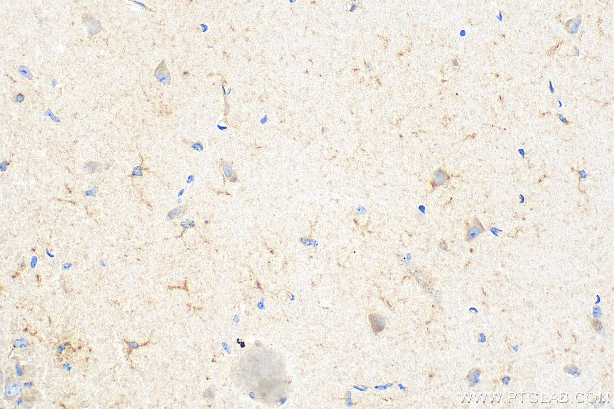 TREM2 antibody (68723-1-PBS) | Proteintech