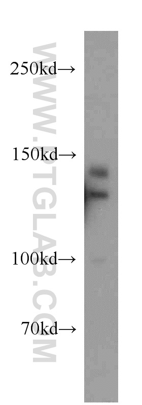 Western Blot (WB) analysis of MCF-7 cells using TRERF1 Polyclonal antibody (20062-1-AP)