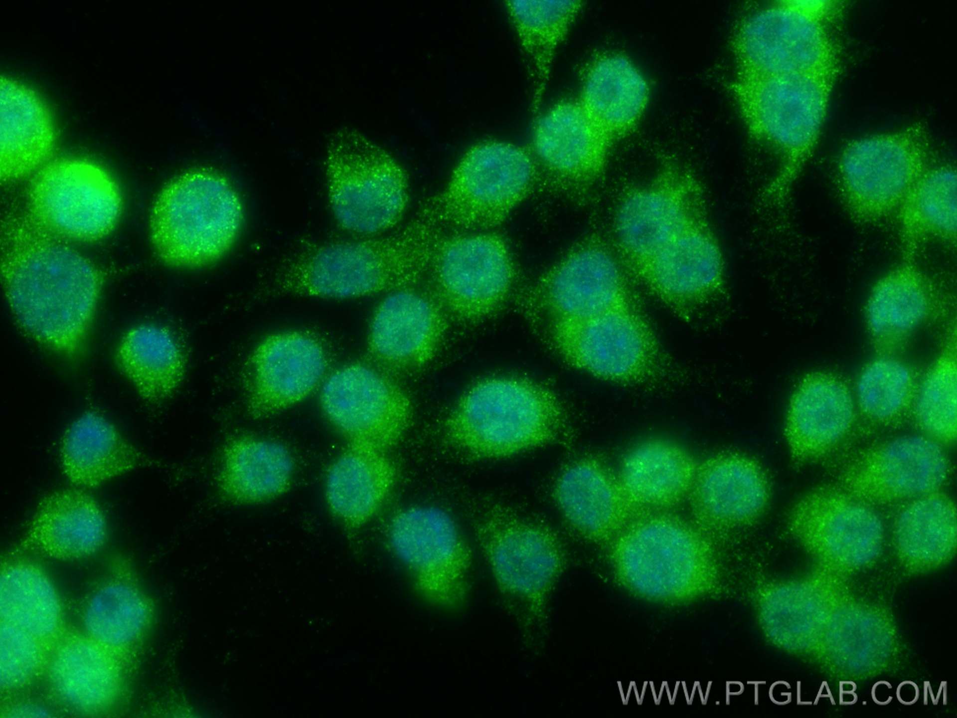 Immunofluorescence (IF) / fluorescent staining of RAW 264.7 cells using TREX1 Polyclonal antibody (24876-1-AP)