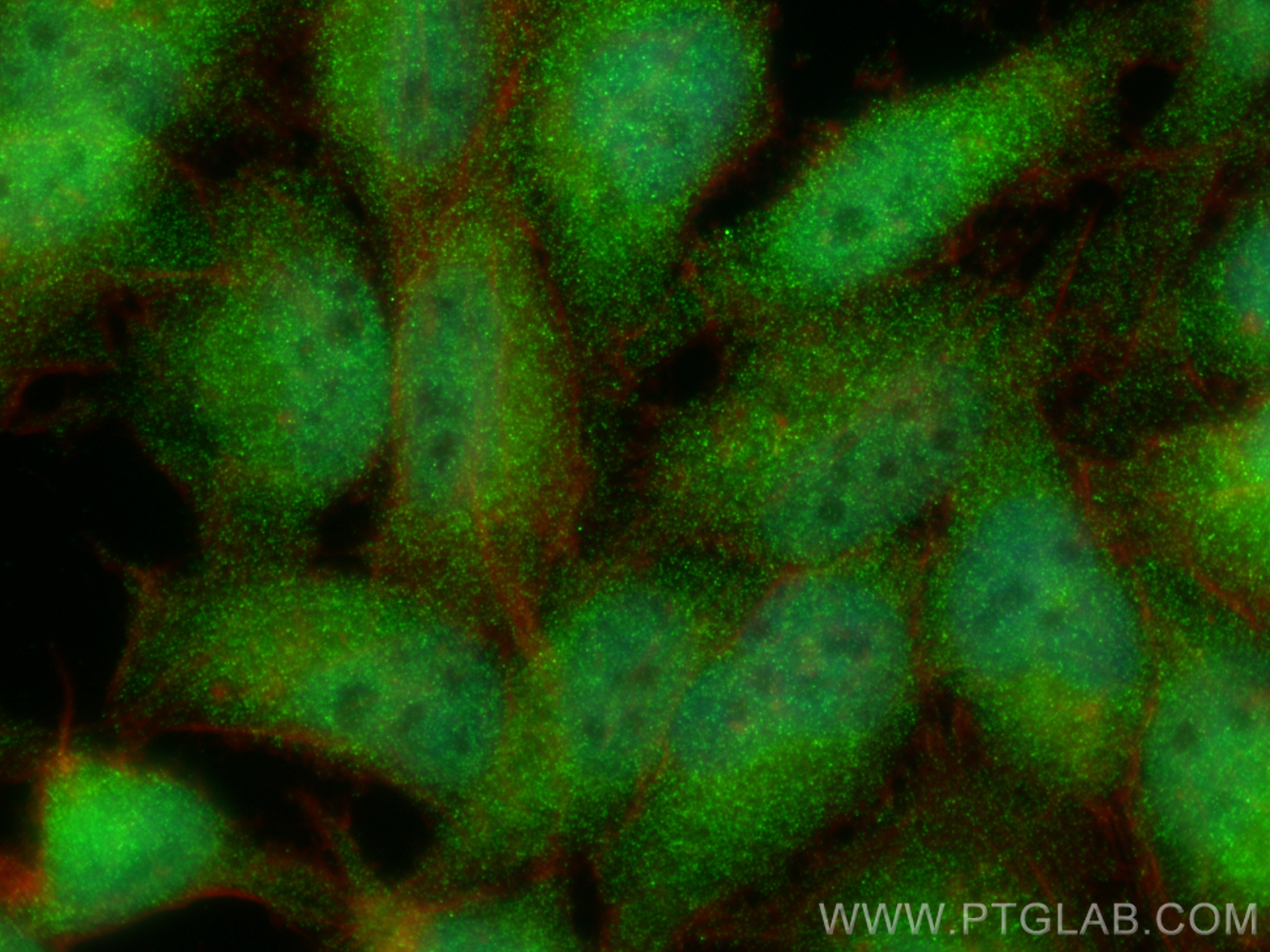 Immunofluorescence (IF) / fluorescent staining of HeLa cells using TREX1 Polyclonal antibody (24876-1-AP)