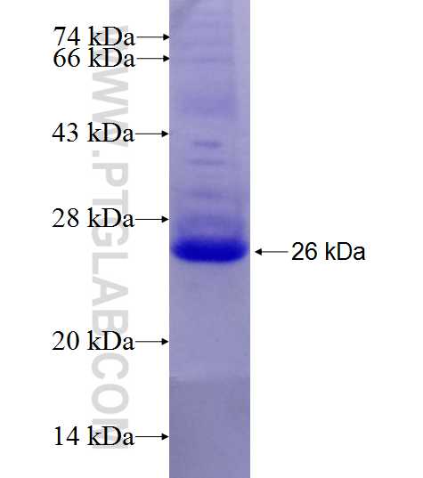 TRIB1 fusion protein Ag27548 SDS-PAGE