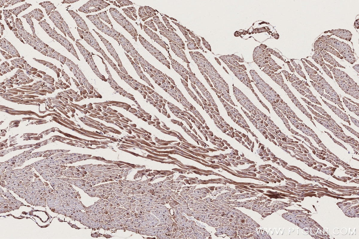 Immunohistochemistry (IHC) staining of mouse heart tissue using TRIM11 Polyclonal antibody (10851-1-AP)