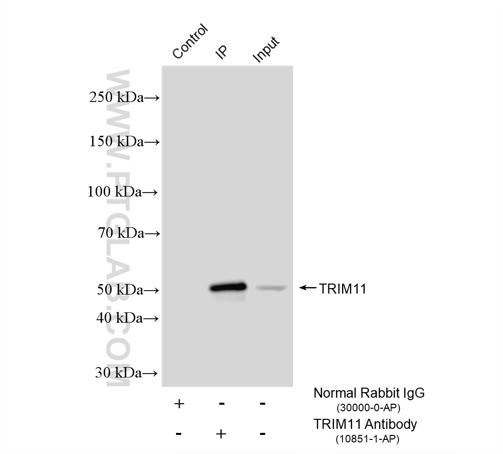 Immunoprecipitation (IP) experiment of HeLa cells using TRIM11 Polyclonal antibody (10851-1-AP)