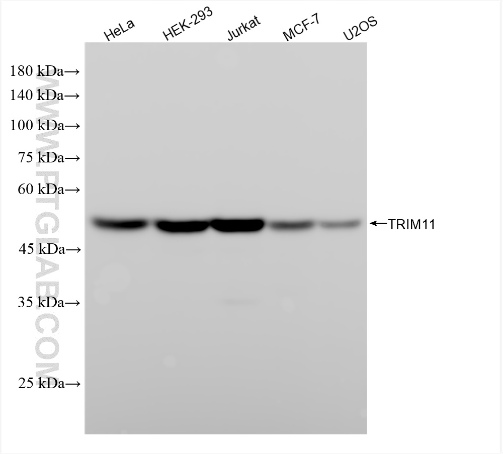 Western Blot (WB) analysis of various lysates using TRIM11 Recombinant antibody (84651-3-RR)