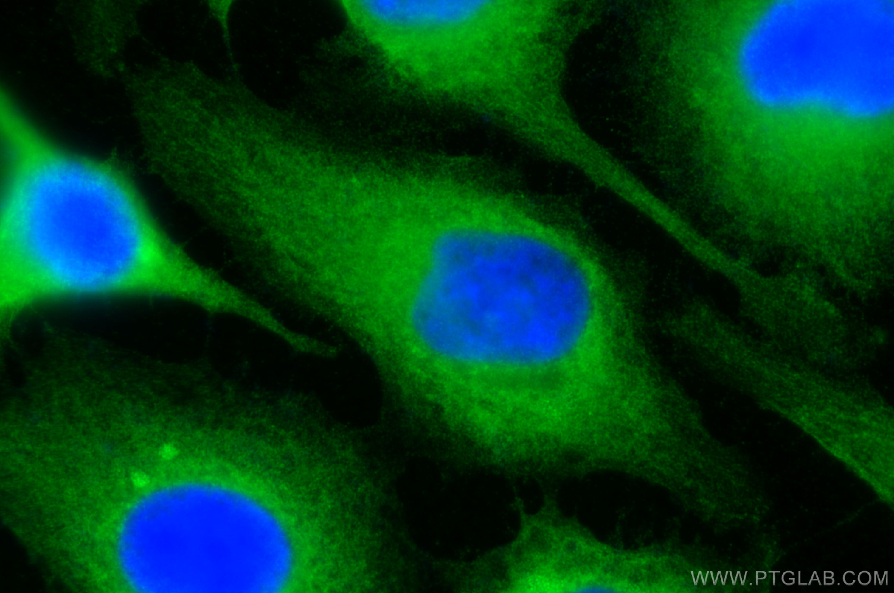 Immunofluorescence (IF) / fluorescent staining of HeLa cells using TRIM14 Polyclonal antibody (15742-1-AP)