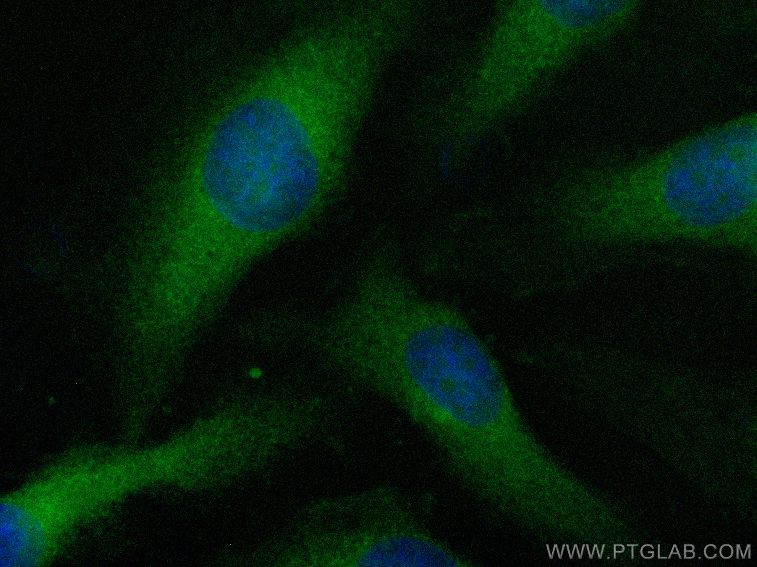 Immunofluorescence (IF) / fluorescent staining of HeLa cells using CoraLite® Plus 488-conjugated TRIM14 Polyclonal an (CL488-15742)