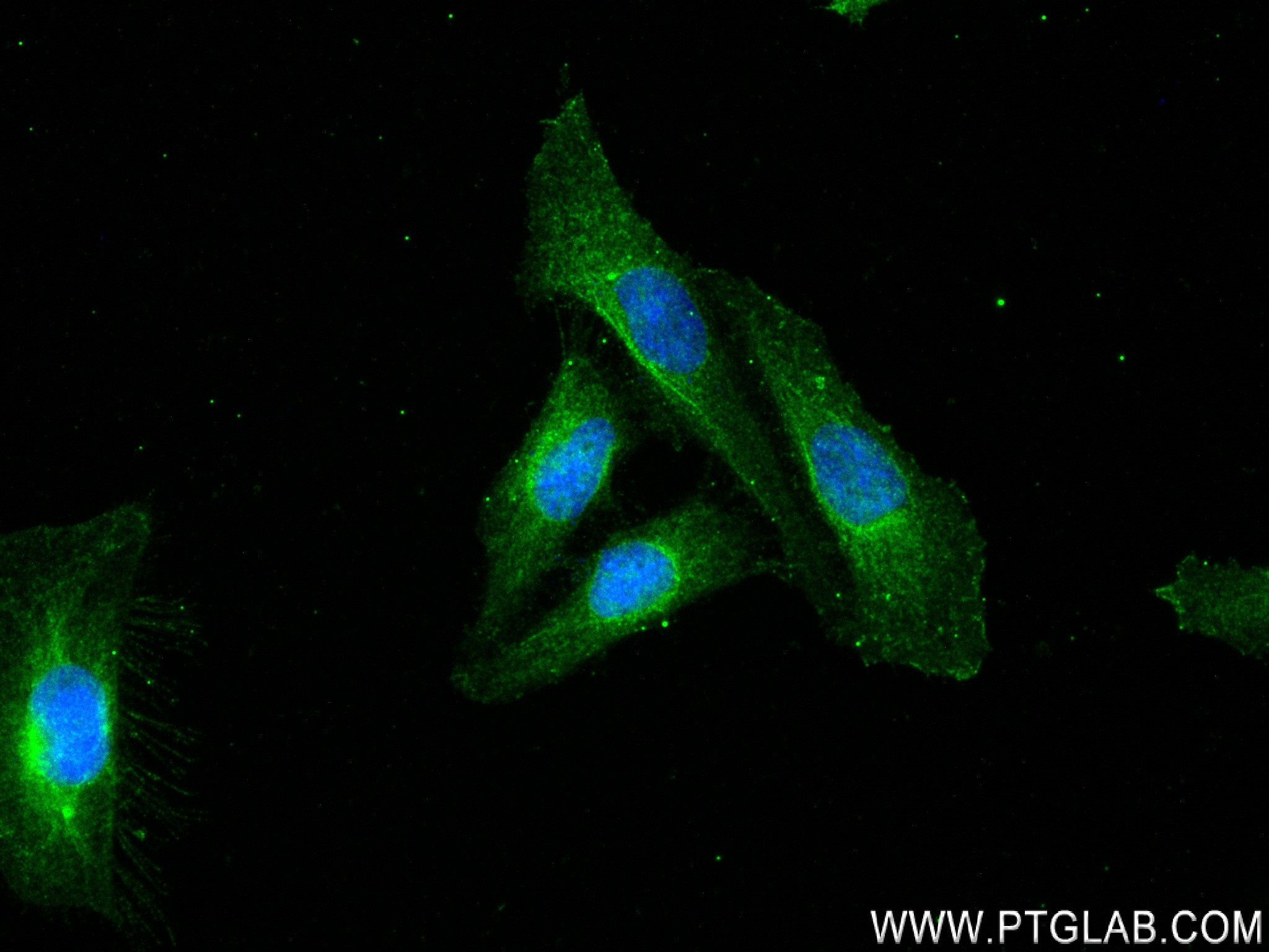 Immunofluorescence (IF) / fluorescent staining of HeLa cells using TRIM15 Recombinant antibody (83582-5-RR)