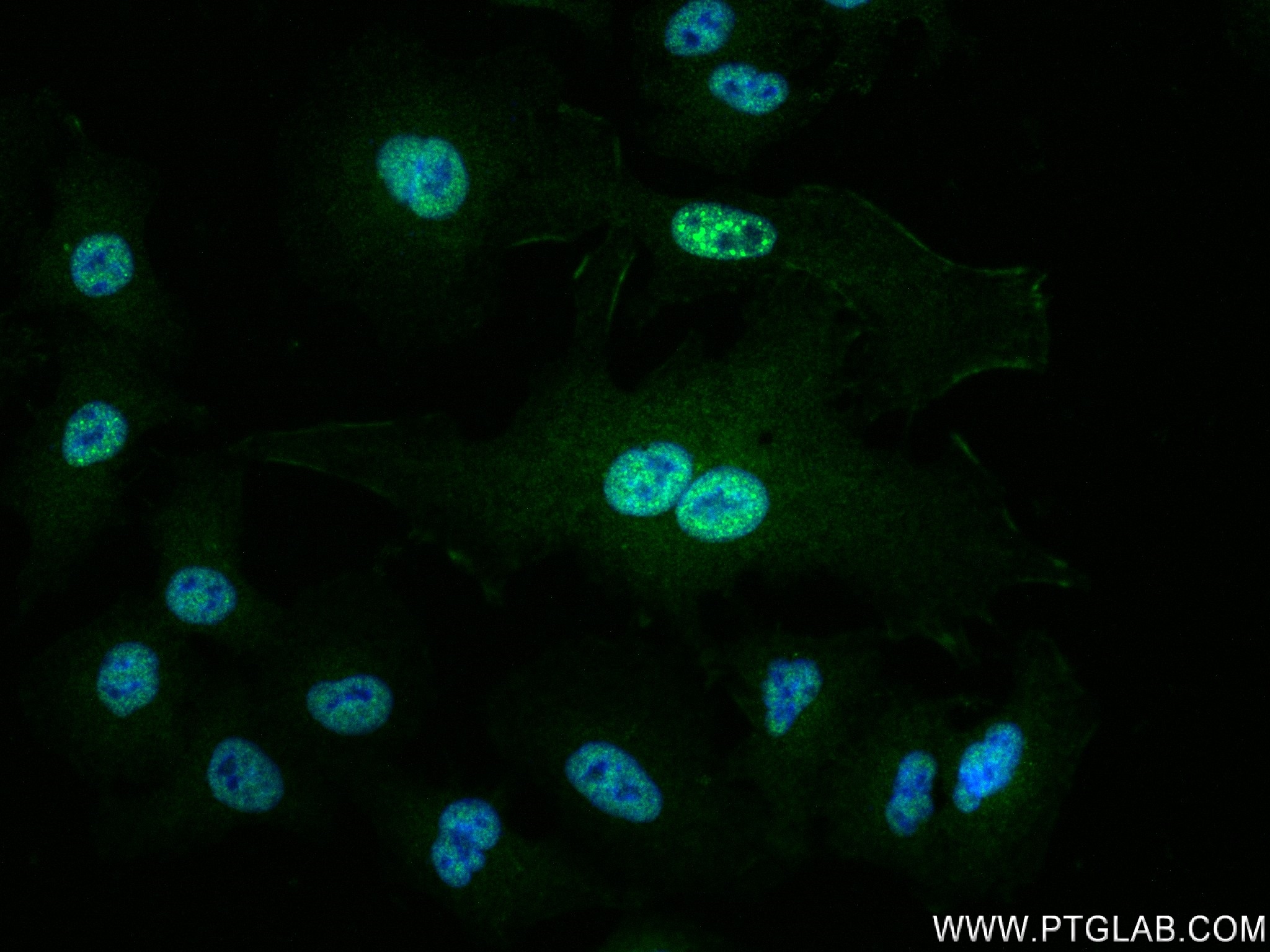 Immunofluorescence (IF) / fluorescent staining of A549 cells using TRIM21 Recombinant antibody (83530-3-RR)