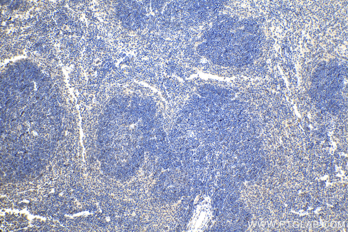 Immunohistochemistry (IHC) staining of mouse spleen tissue using TRIM22 Polyclonal antibody (13744-1-AP)