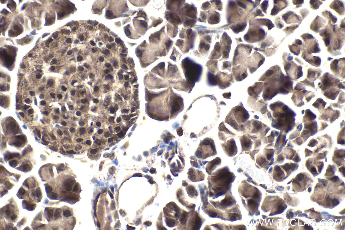 Immunohistochemistry (IHC) staining of mouse pancreas tissue using TRIM22 Polyclonal antibody (13744-1-AP)
