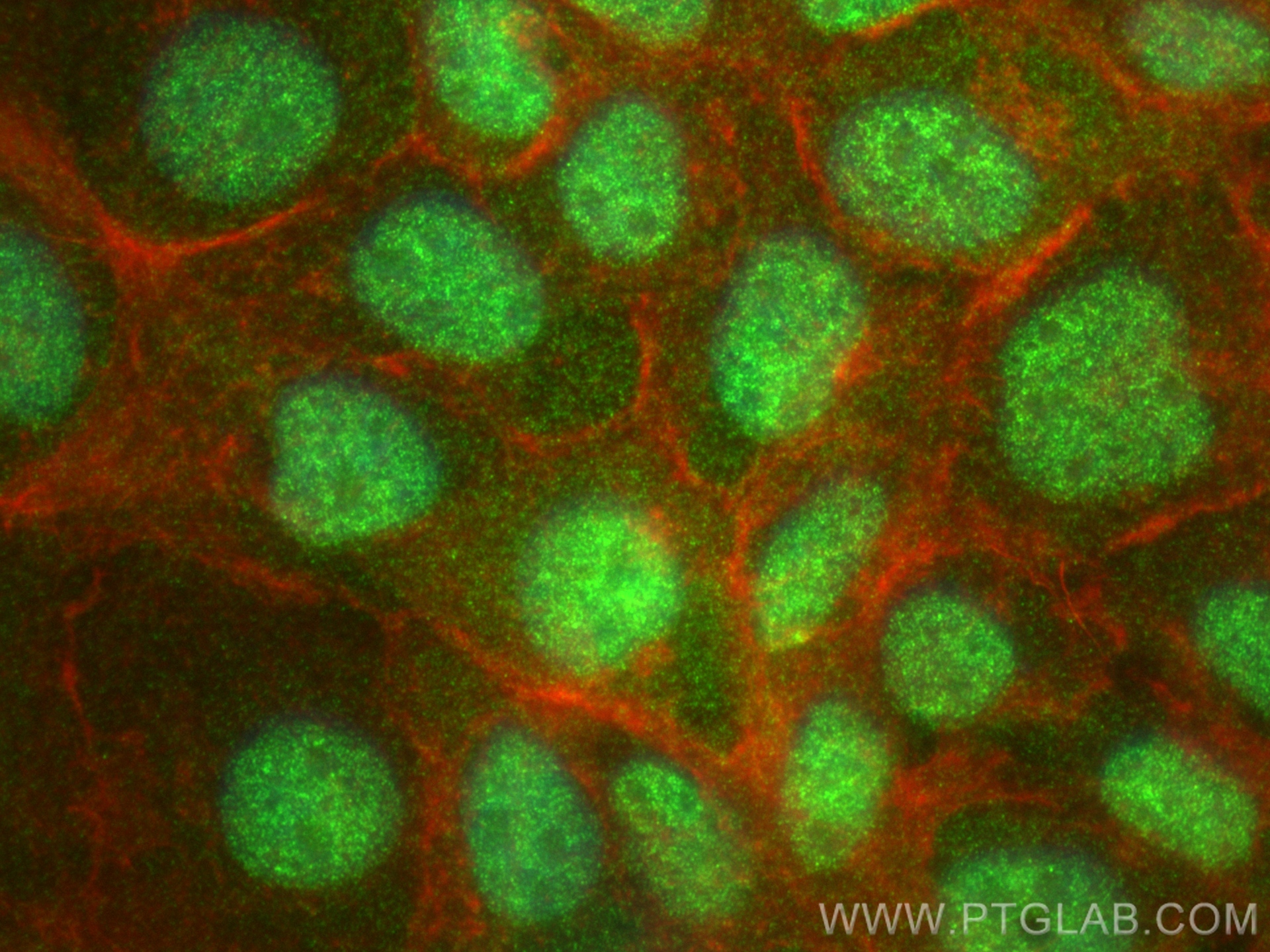 Immunofluorescence (IF) / fluorescent staining of A431 cells using TRIM22 Recombinant antibody (83479-4-RR)