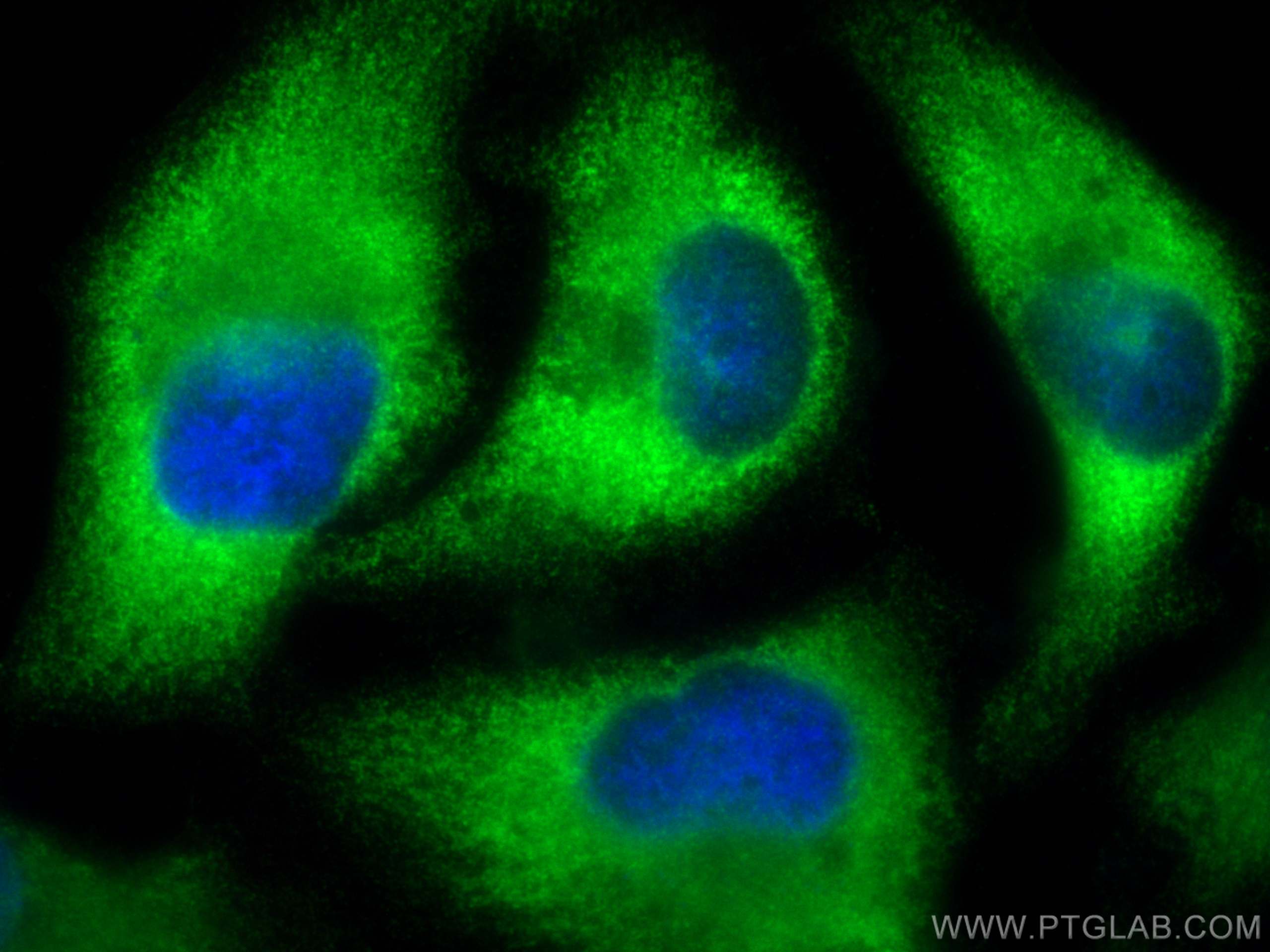 Immunofluorescence (IF) / fluorescent staining of HeLa cells using TRIM25 Polyclonal antibody (12573-1-AP)