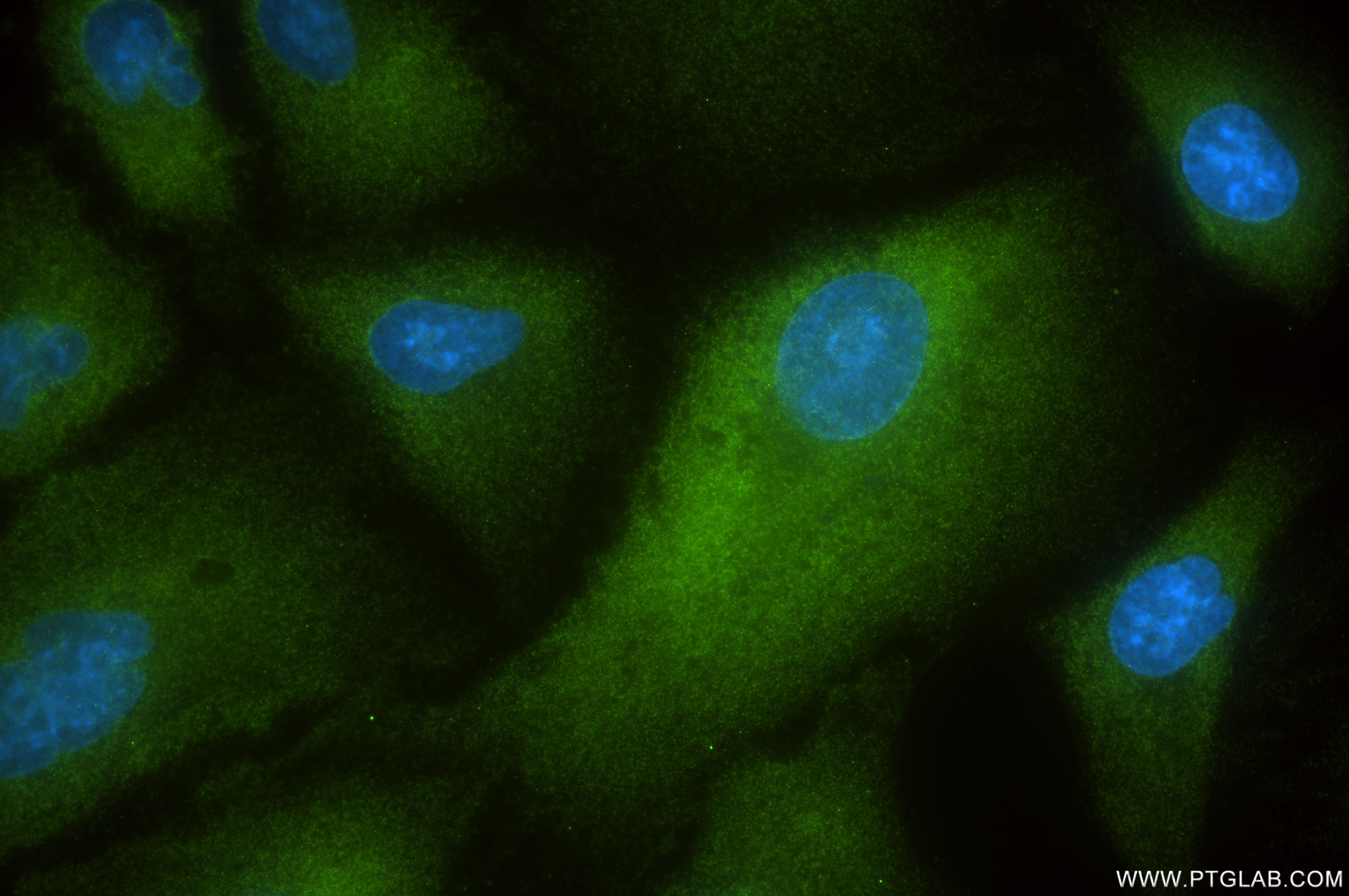 Immunofluorescence (IF) / fluorescent staining of A549 cells using TRIM25 Recombinant antibody (85919-1-RR)